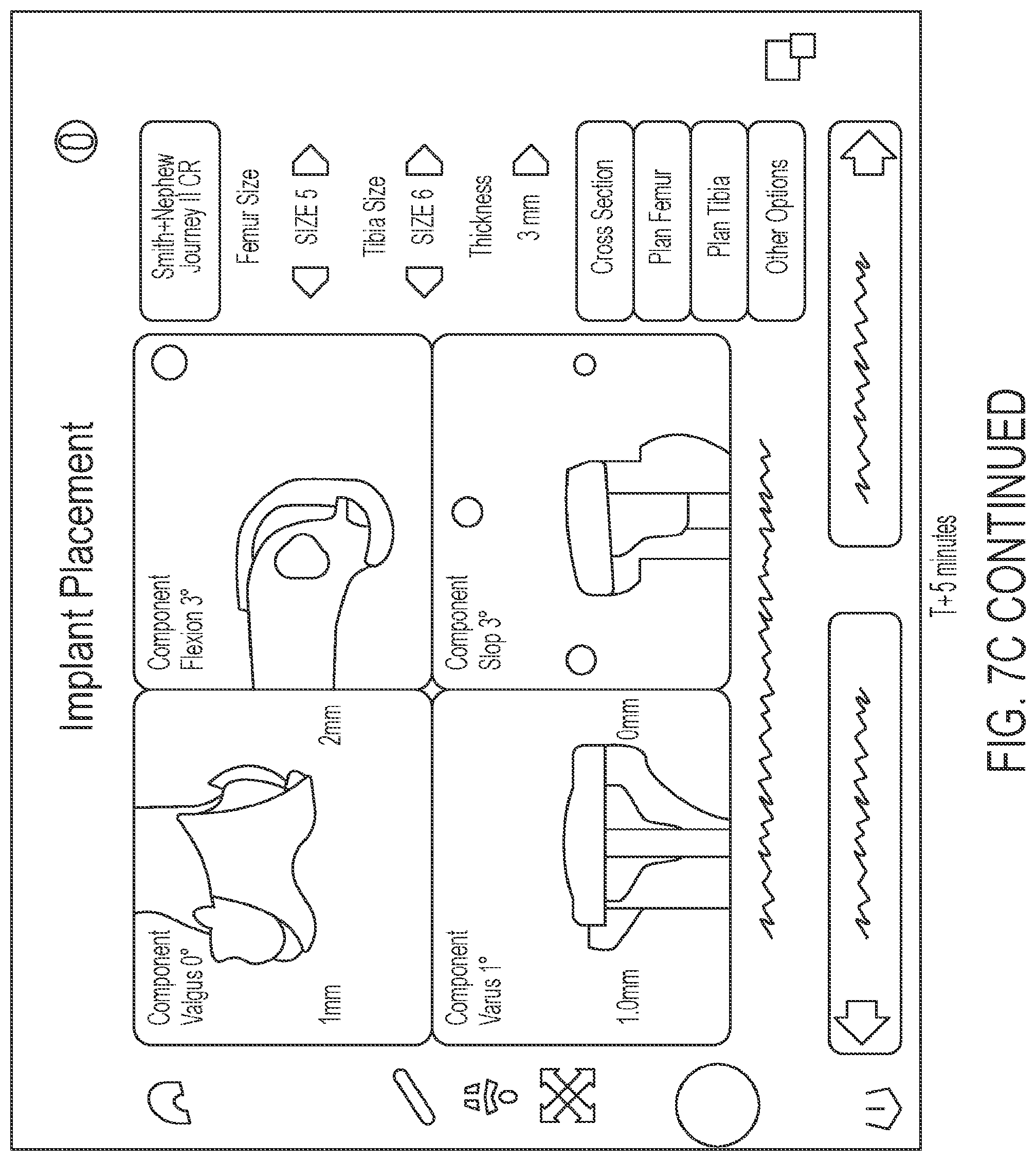 Patent US12303216 Figure 13 – Surgical tracking methods and fiber optic shape sensing devices thereof