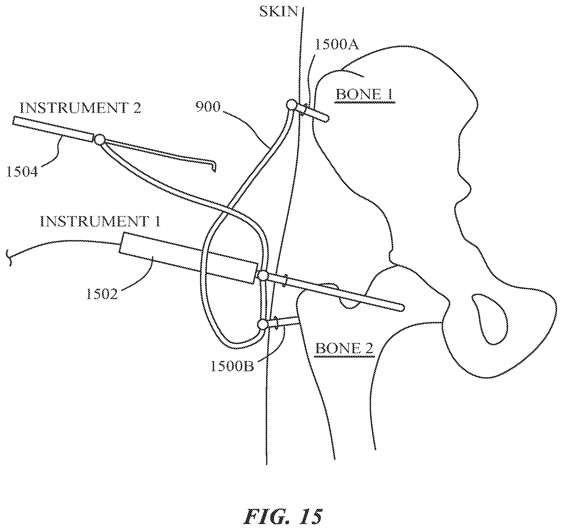 Patent US12303216 Figure 20 – Surgical tracking methods and fiber optic shape sensing devices thereof