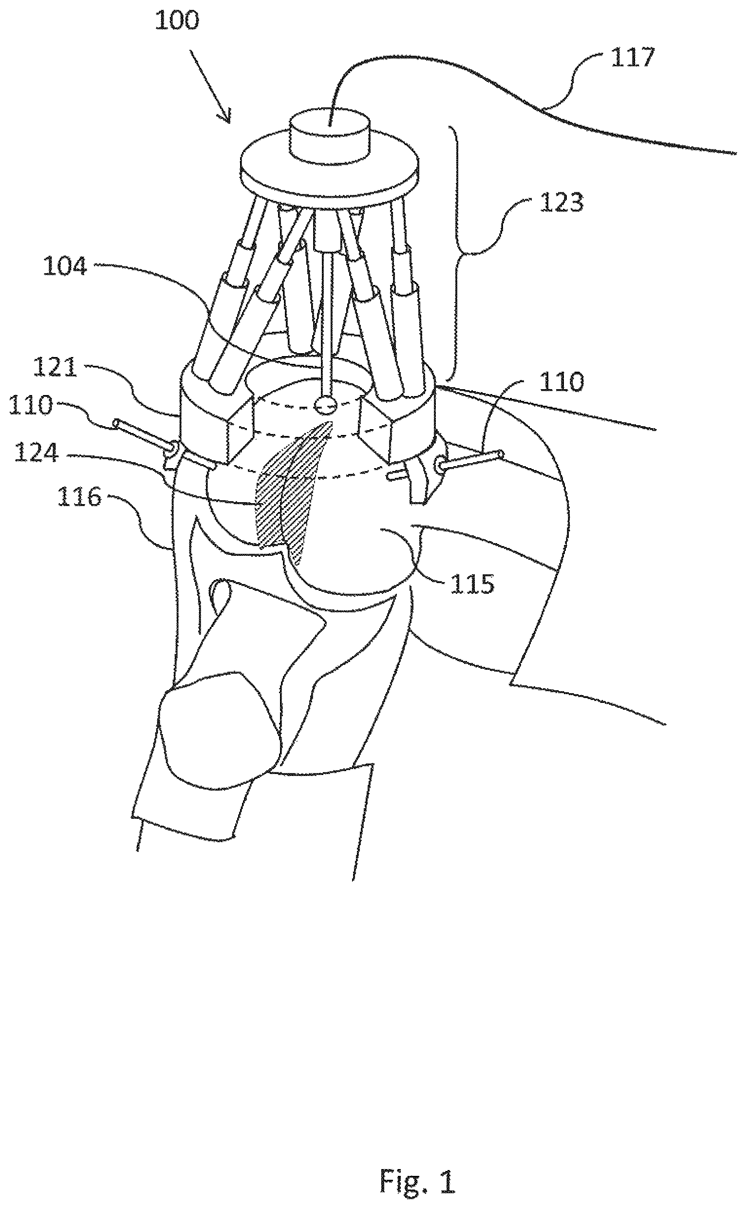 Patent US12303219 Figure 1 – Miniature bone-mounted robot for IN-SITU three-dimensional bioprinting