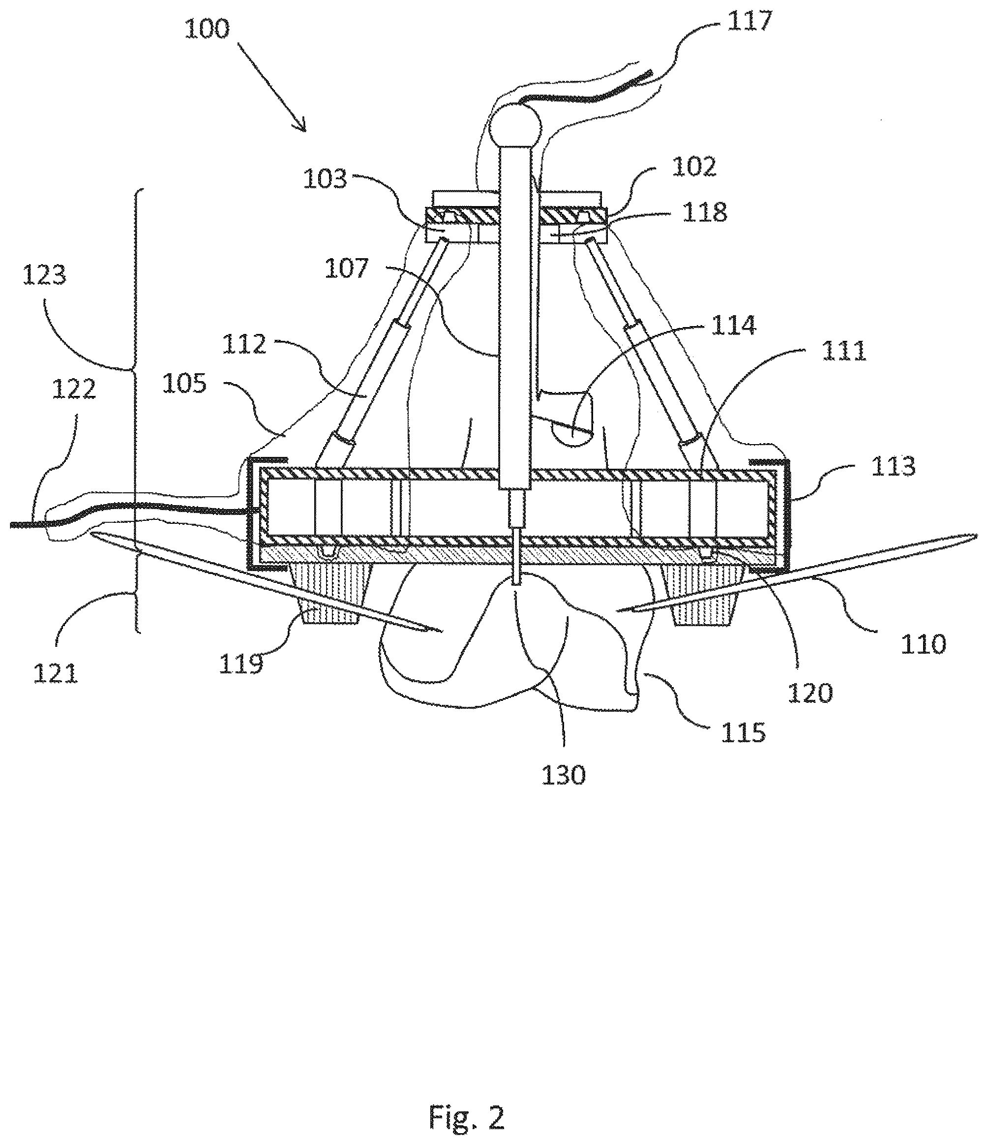 Patent US12303219 Figure 2 – Miniature bone-mounted robot for IN-SITU three-dimensional bioprinting
