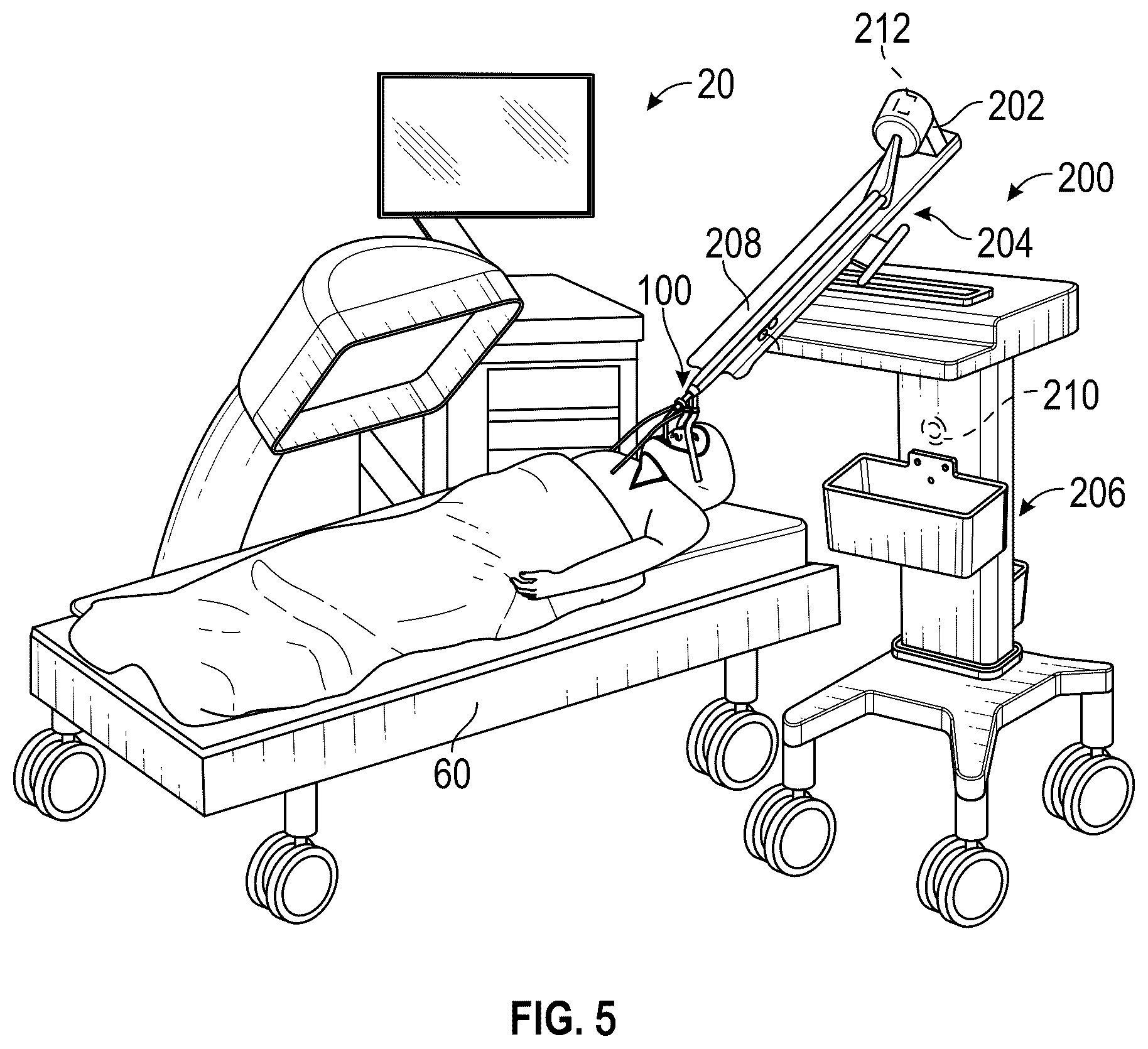 Patent US12303220 Figure 4 – Autonomous endobronchial access with an EM guided catheter