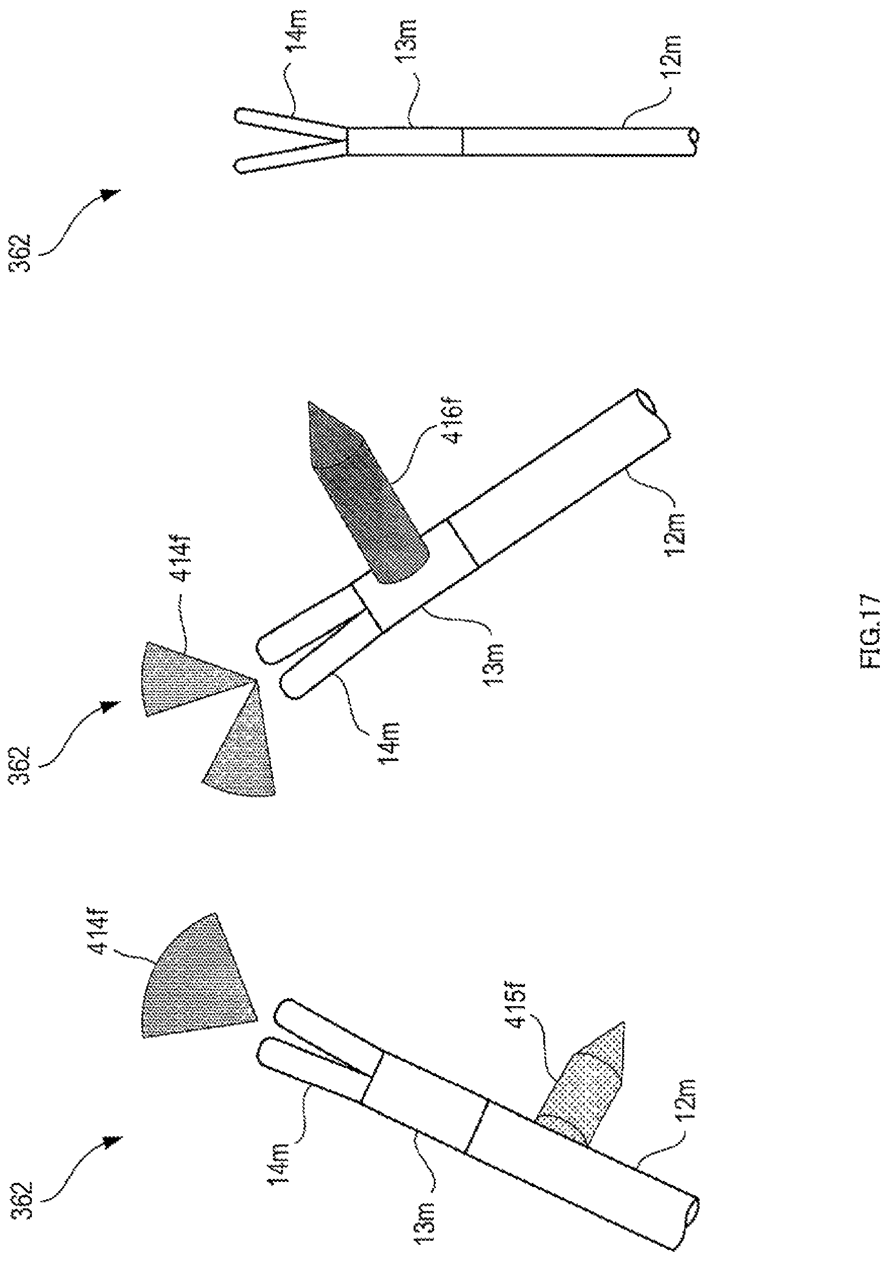 Patent US12303227 Figure 17 – Force sense display device and force sense display method