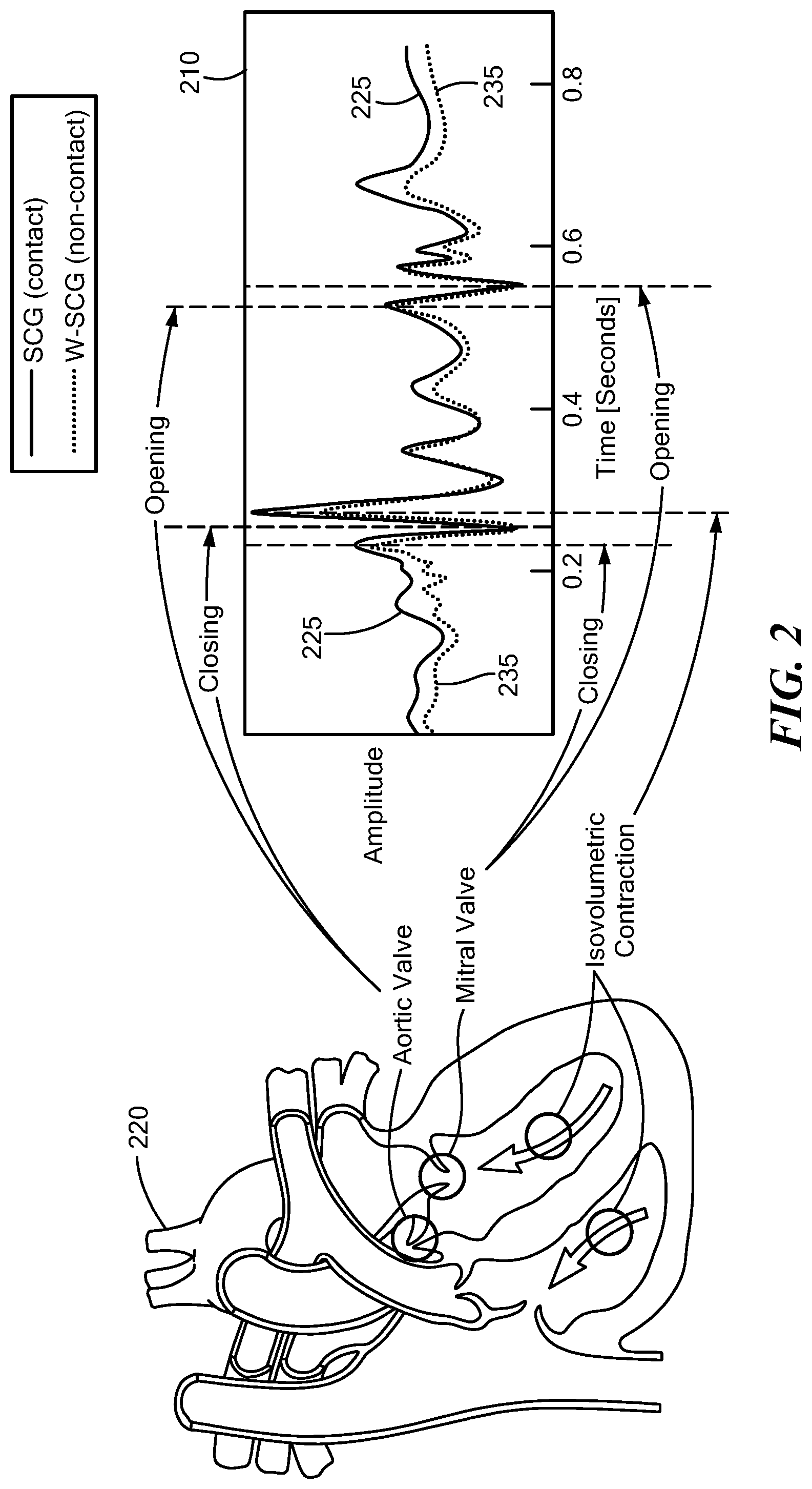 Patent US12303236 Figure 2 – Contactless seismocardiography