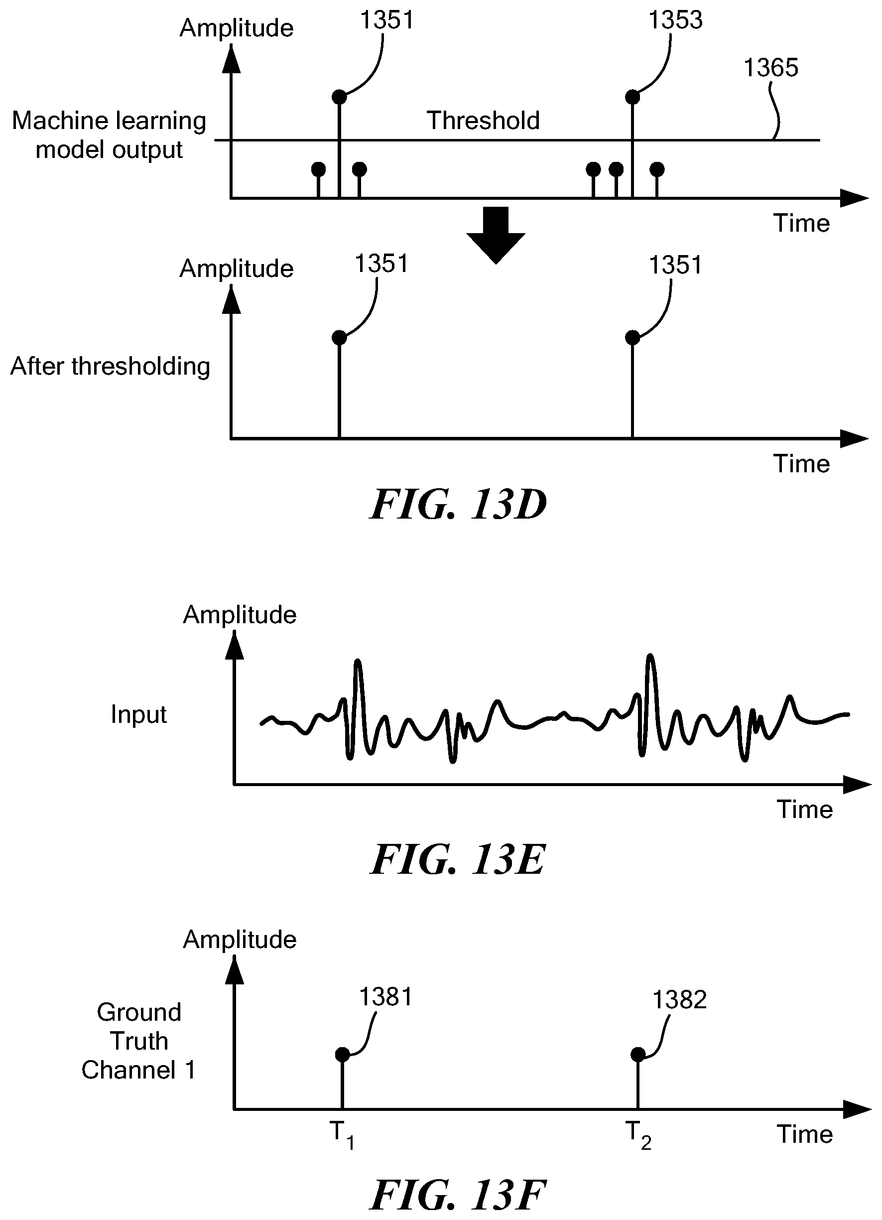 Patent US12303236 Figure 17 – Contactless seismocardiography