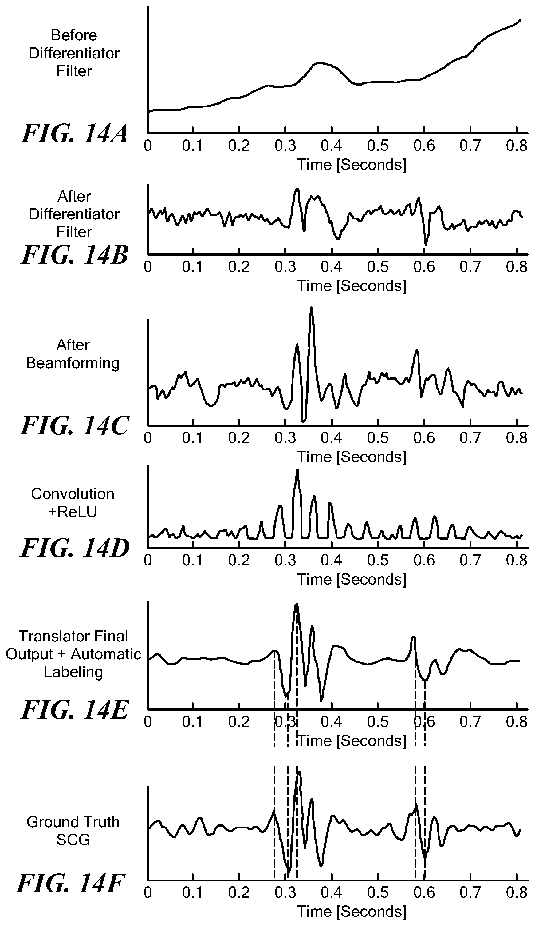 Patent US12303236 Figure 19 – Contactless seismocardiography
