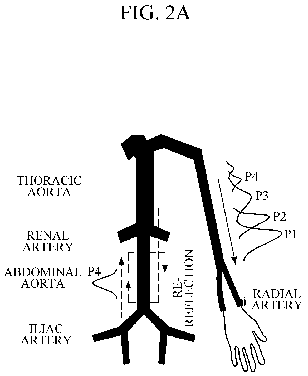 Patent US12303239 Figure 2 – Apparatus for estimating bio-information and method of detecting abnormal bio-signal