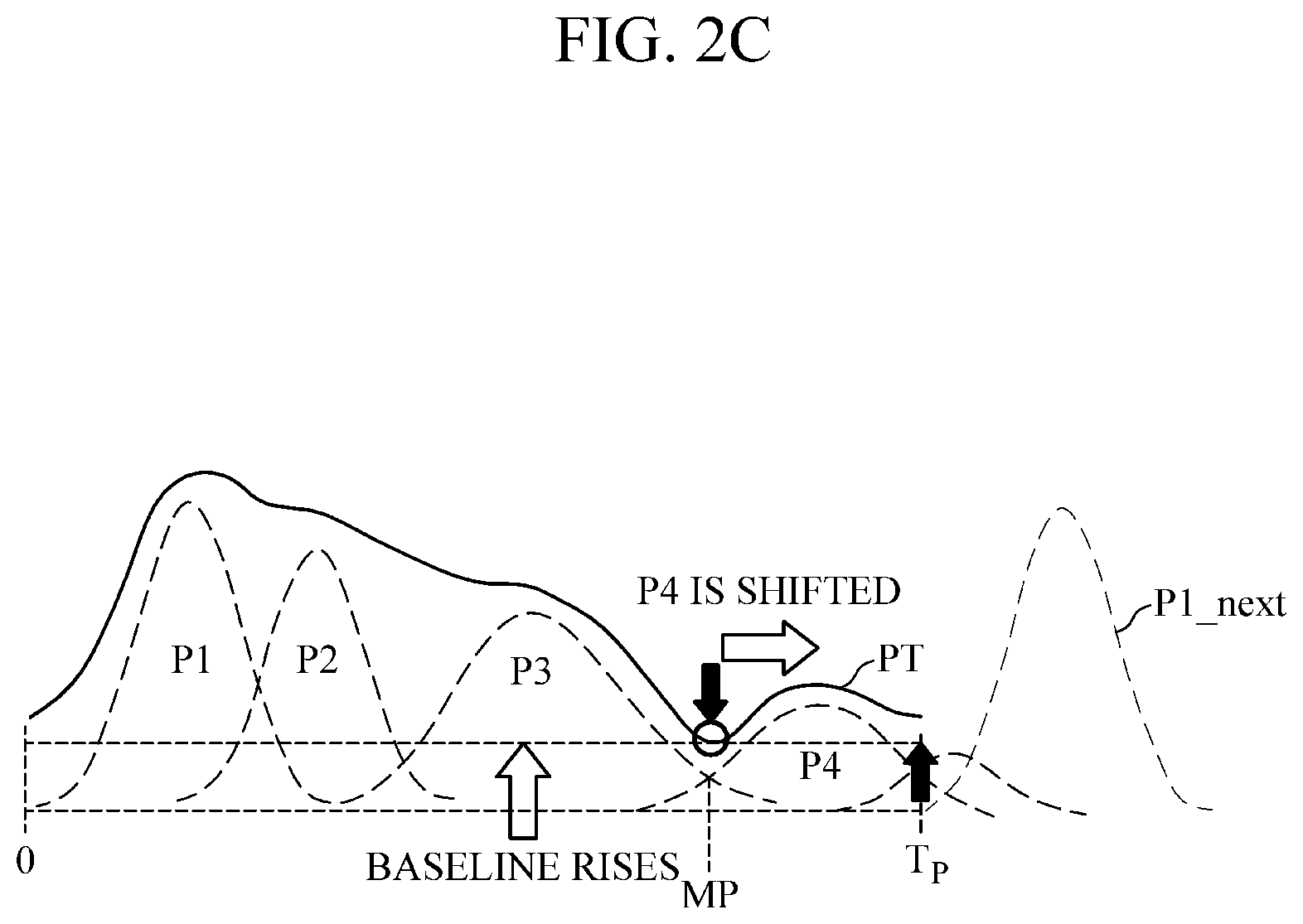 Patent US12303239 Figure 4 – Apparatus for estimating bio-information and method of detecting abnormal bio-signal