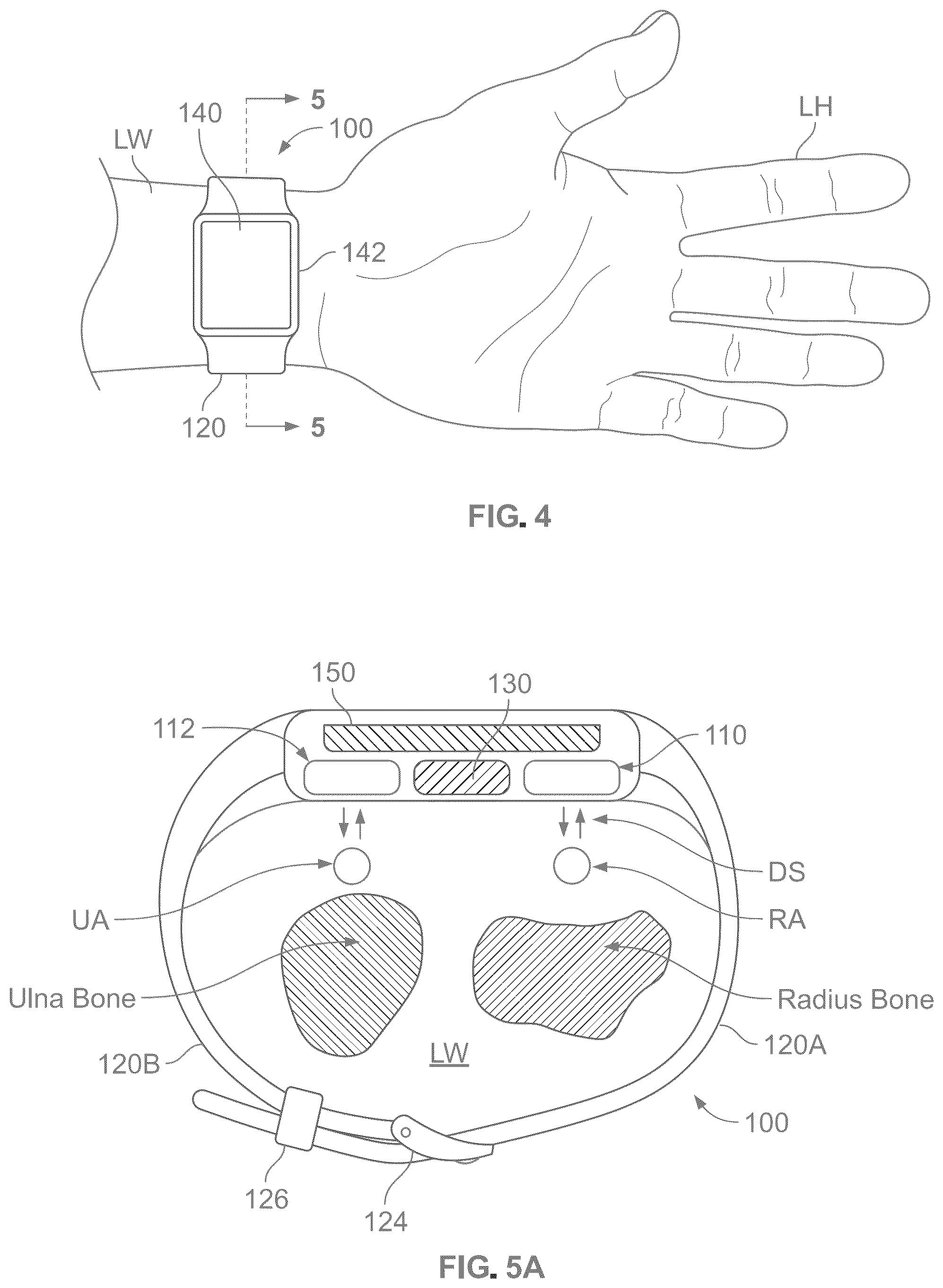 Patent US12303240 Figure 2 – Non-invasive non-compressive blood pressure monitoring device