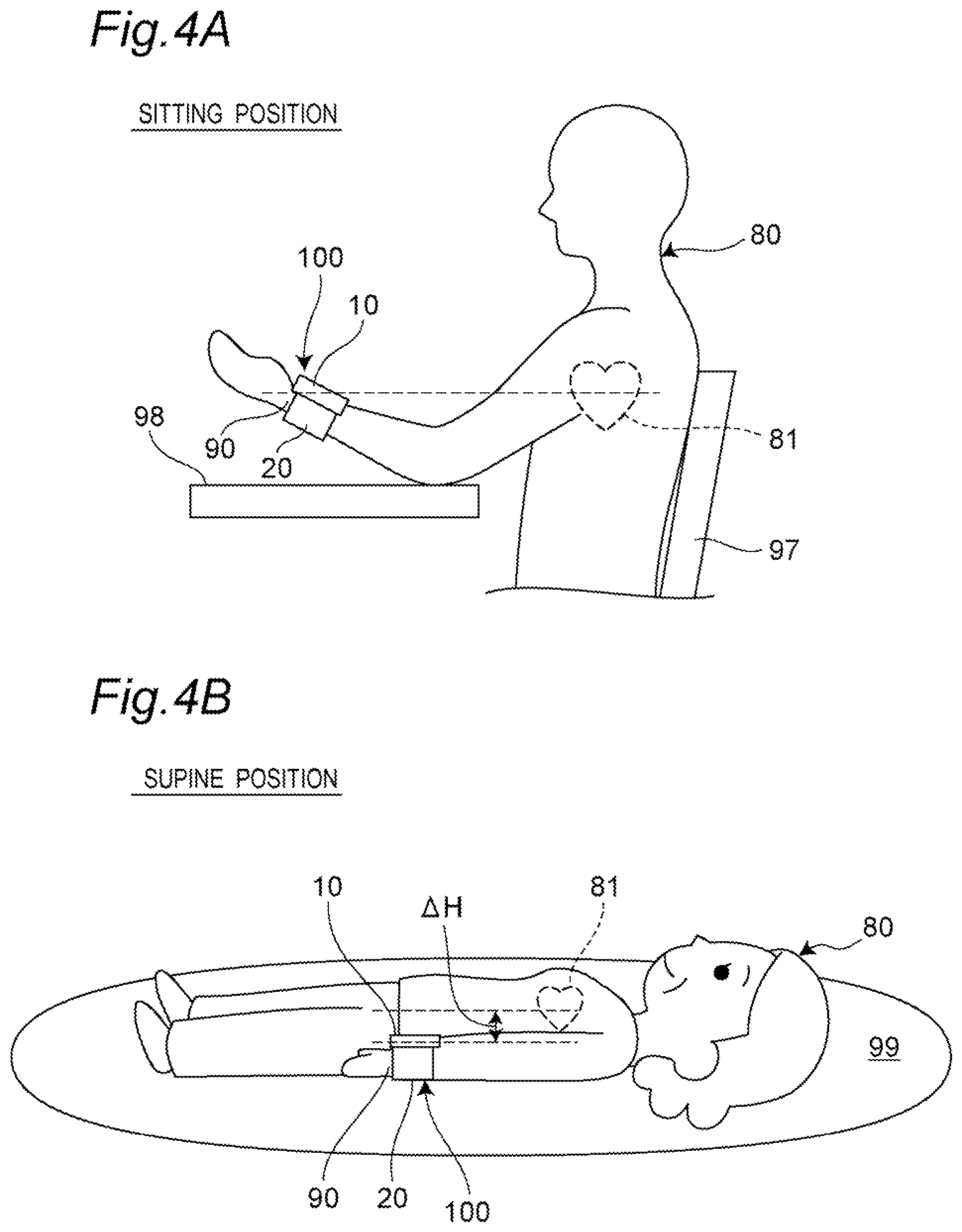 Patent US12303241 Figure 4 – Sphygmomanometer, blood pressure calculation method, and computer-readable recording medium