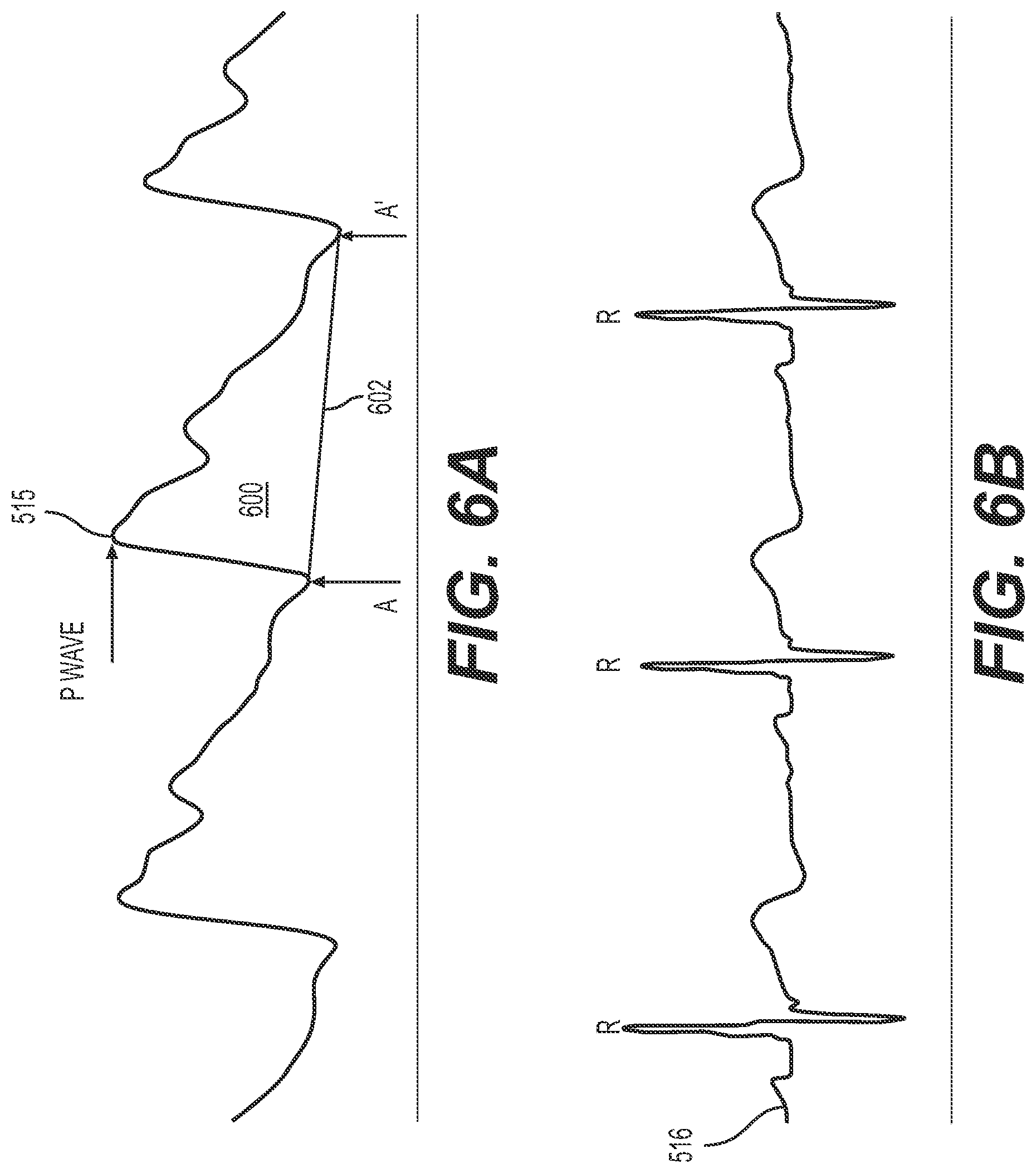 Patent US12303243 Figure 5 – Devices and methods for determining blood flow around a body lumen