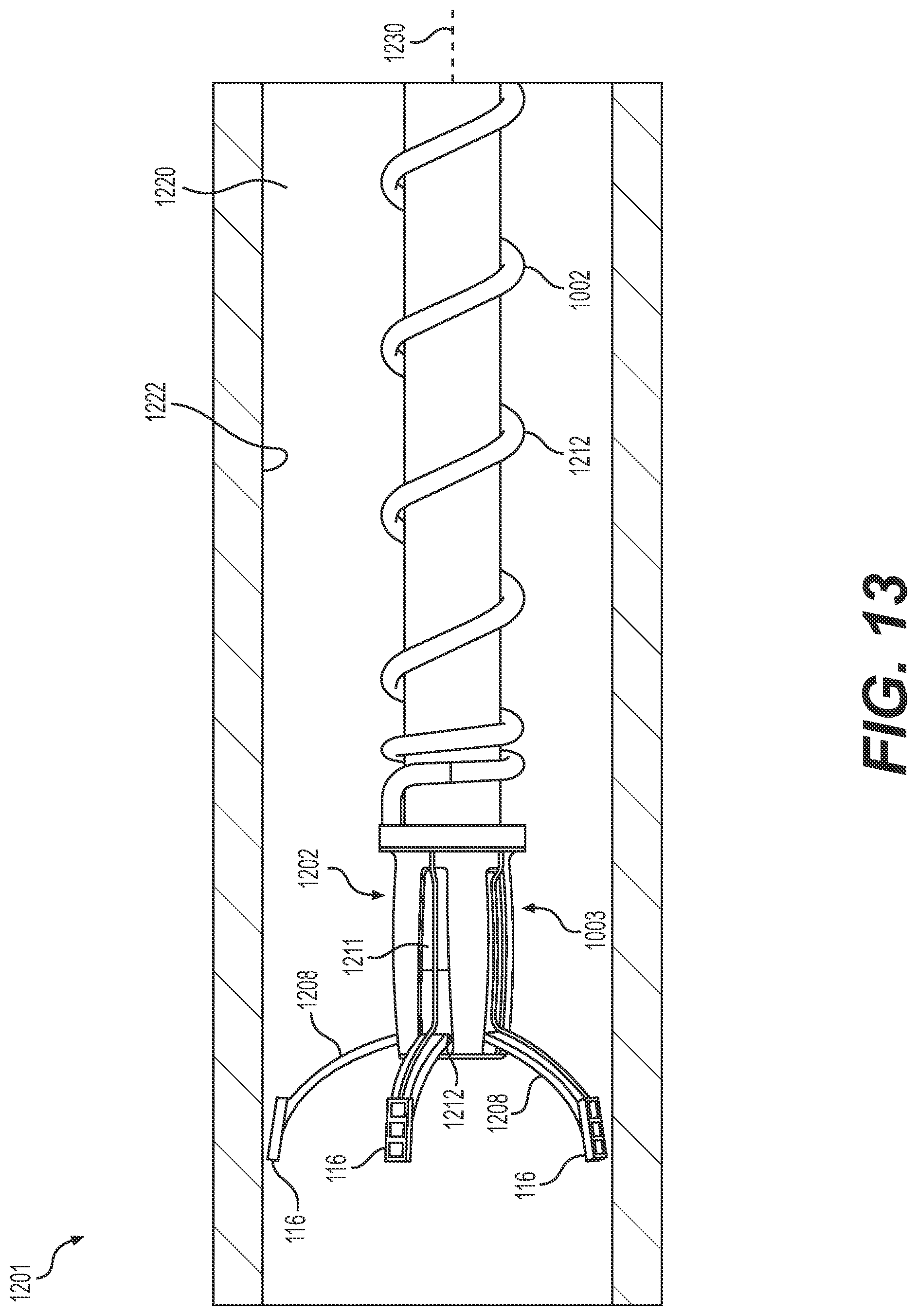 Patent US12303243 Figure 12 – Devices and methods for determining blood flow around a body lumen