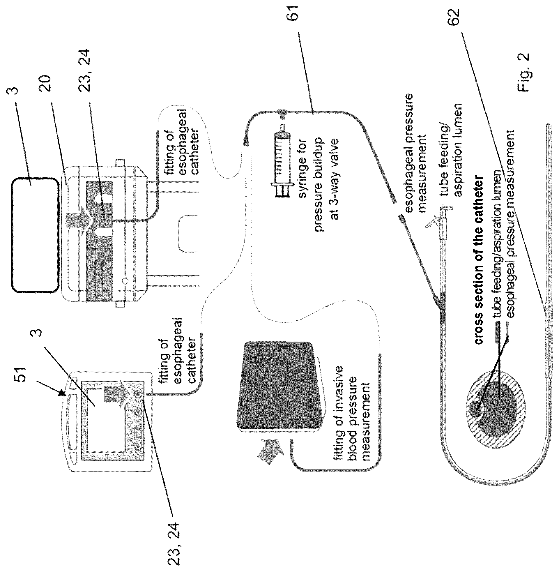 Patent US12303244 Figure 2 – System for recording the breathing efforts of a patient
