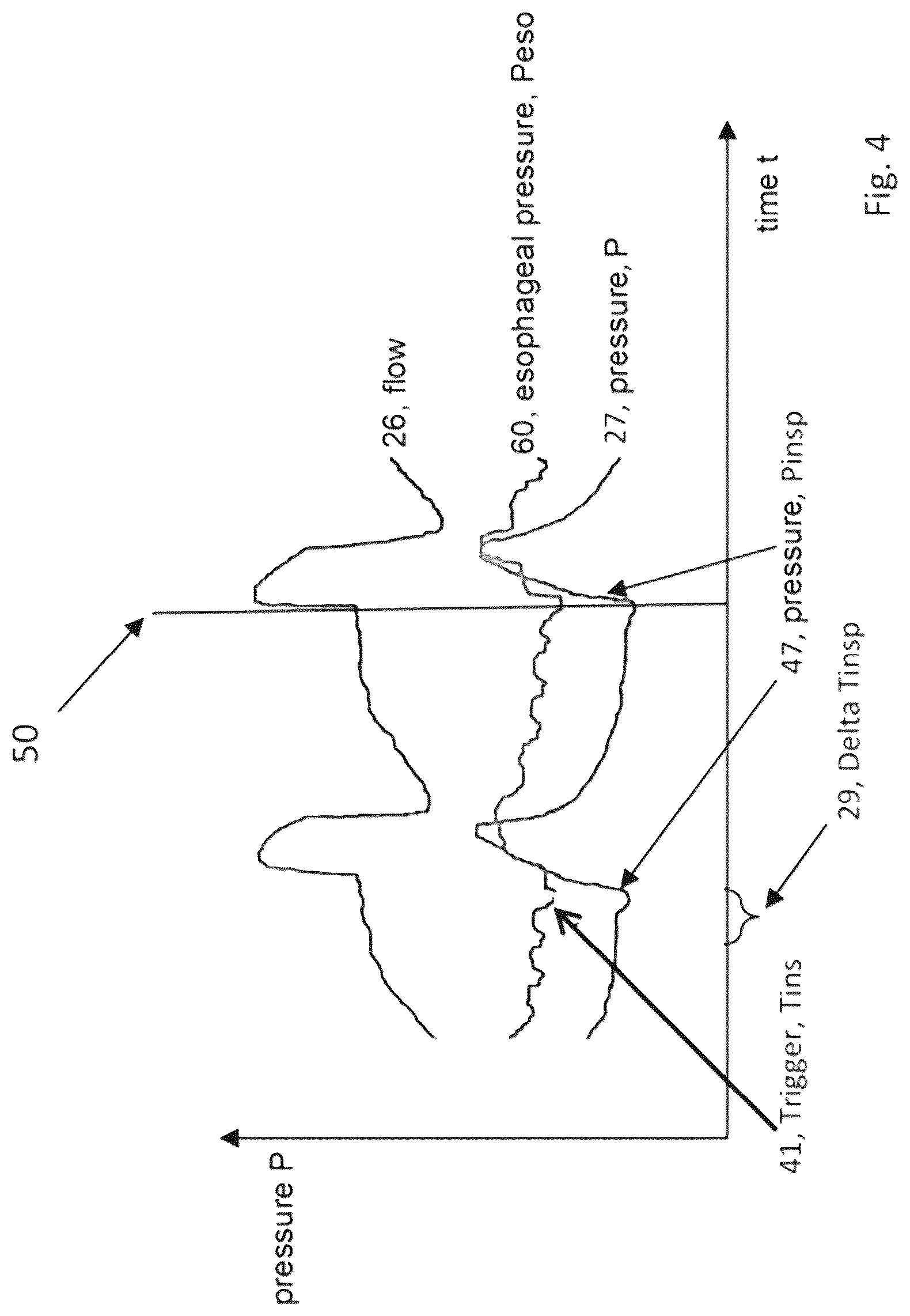 Patent US12303244 Figure 4 – System for recording the breathing efforts of a patient