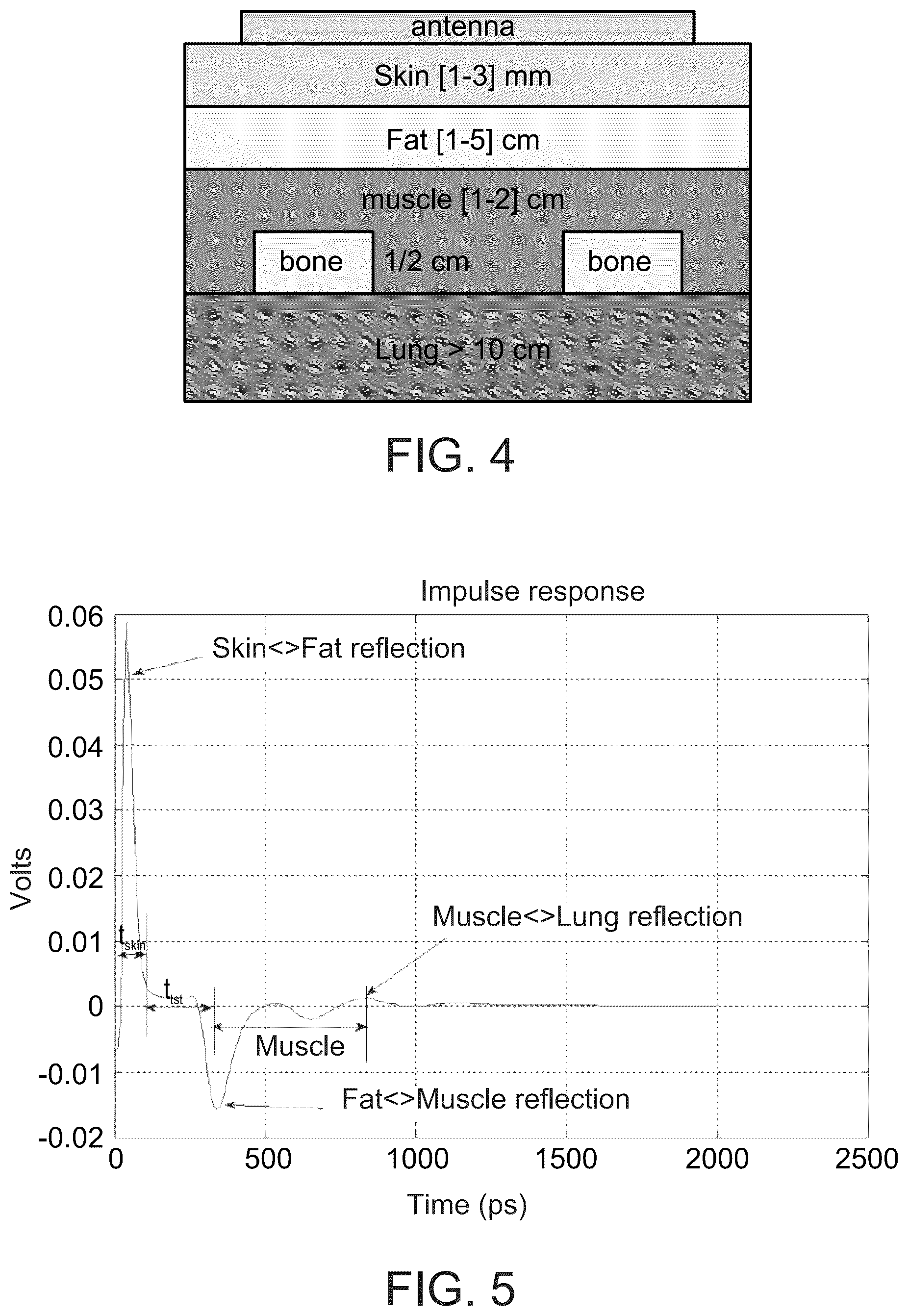 Patent US12303245 Figure 4 – Method and system for monitoring thoracic tissue fluid