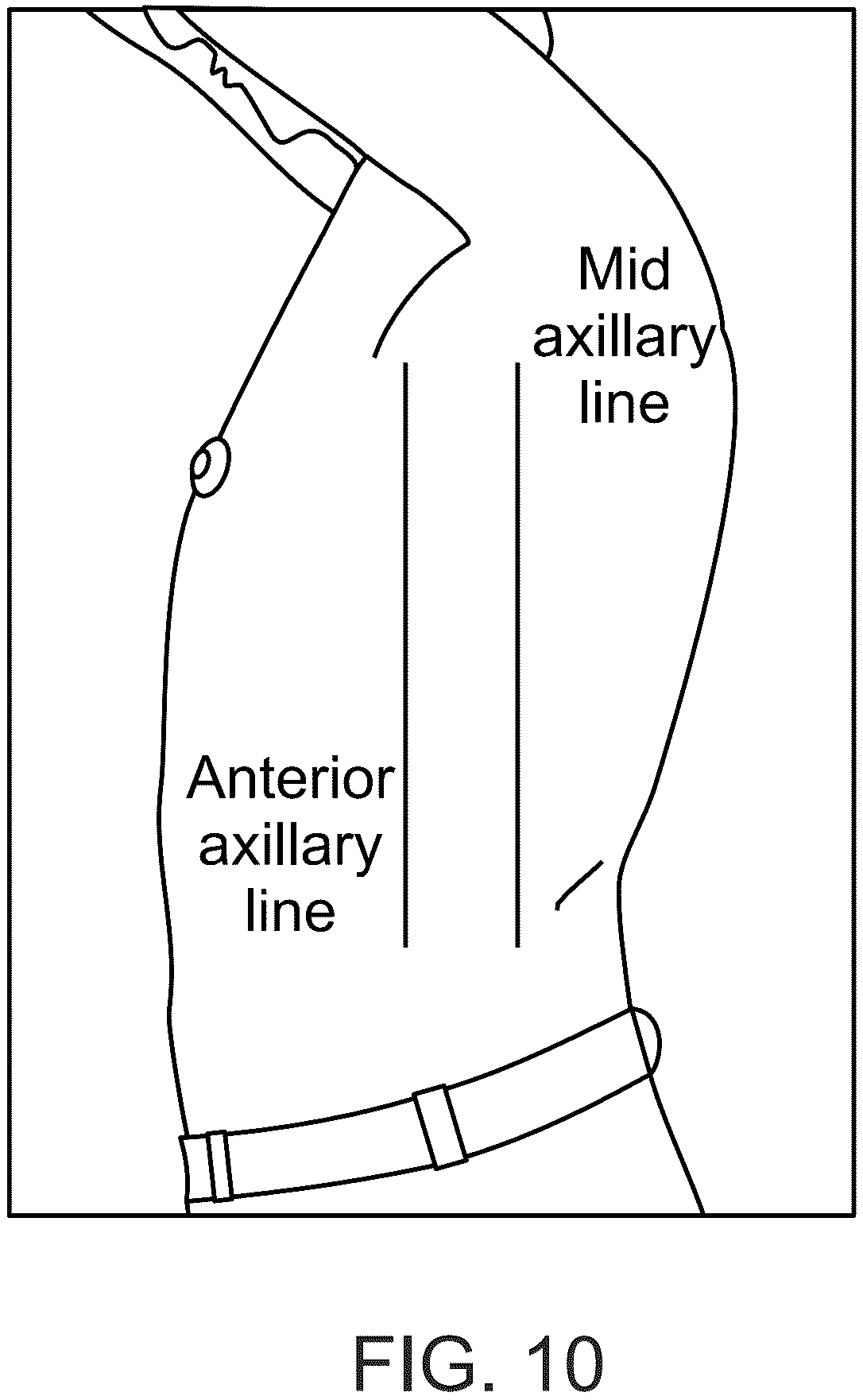 Patent US12303245 Figure 11 – Method and system for monitoring thoracic tissue fluid