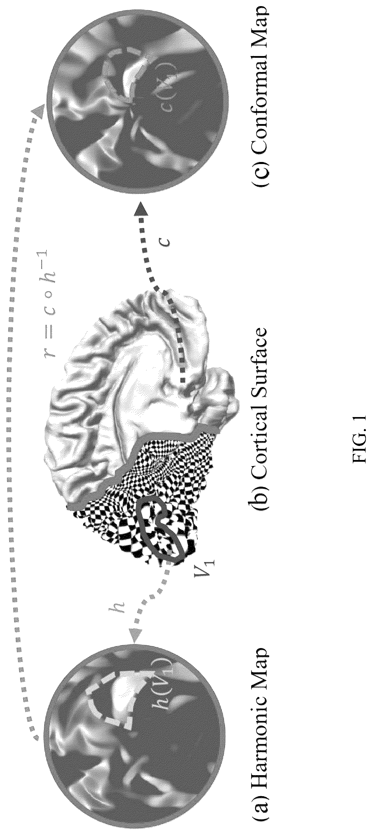 Patent US12303246 Figure 1 – Methods and systems for precise quantification of human sensory cortical areas
