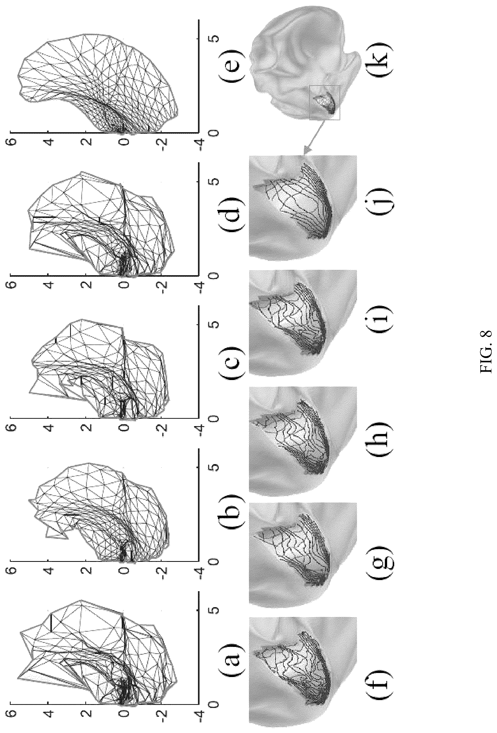 Patent US12303246 Figure 8 – Methods and systems for precise quantification of human sensory cortical areas
