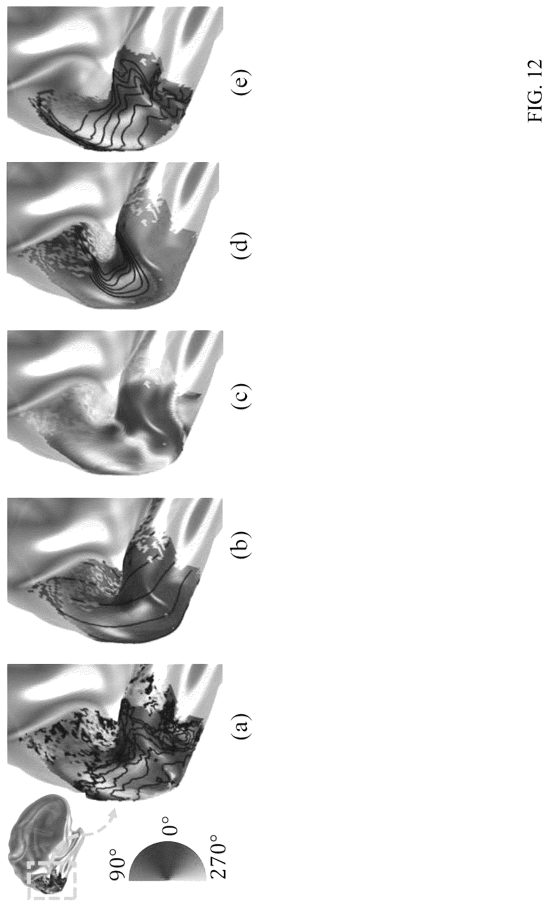 Patent US12303246 Figure 12 – Methods and systems for precise quantification of human sensory cortical areas