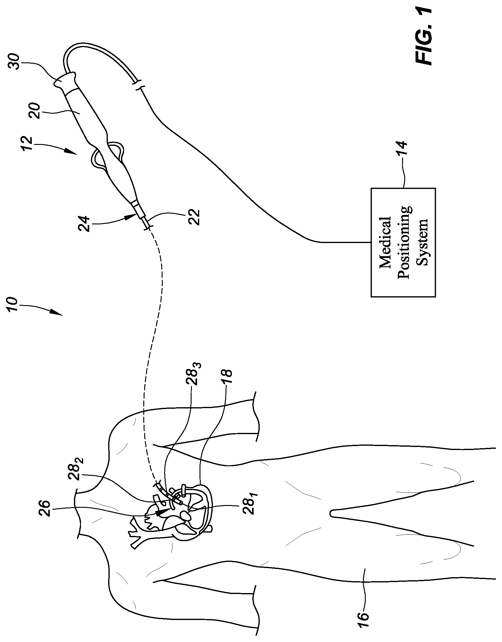 Patent US12303249 Figure 1 – Localized magnetic field generator
