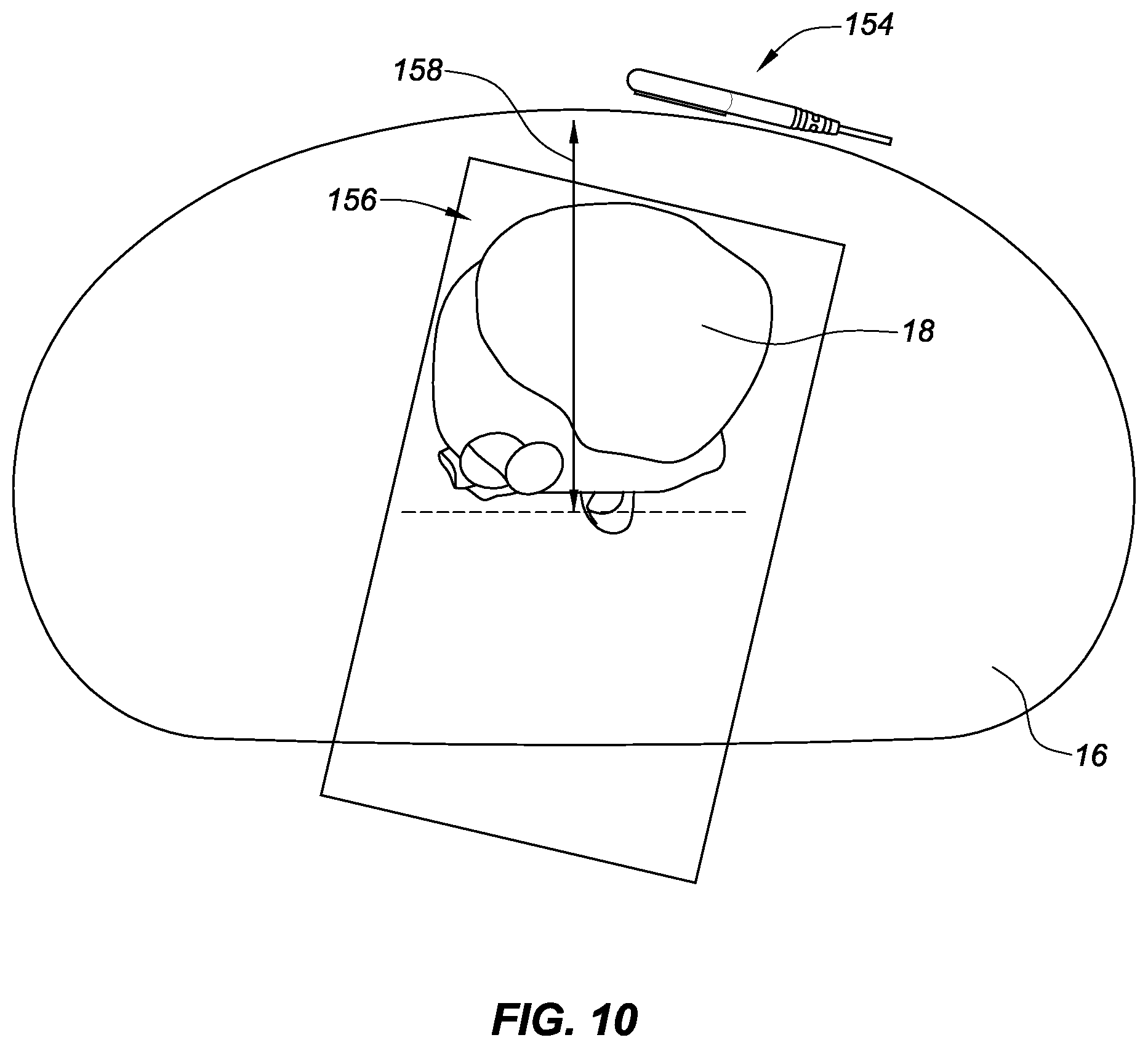 Patent US12303249 Figure 12 – Localized magnetic field generator