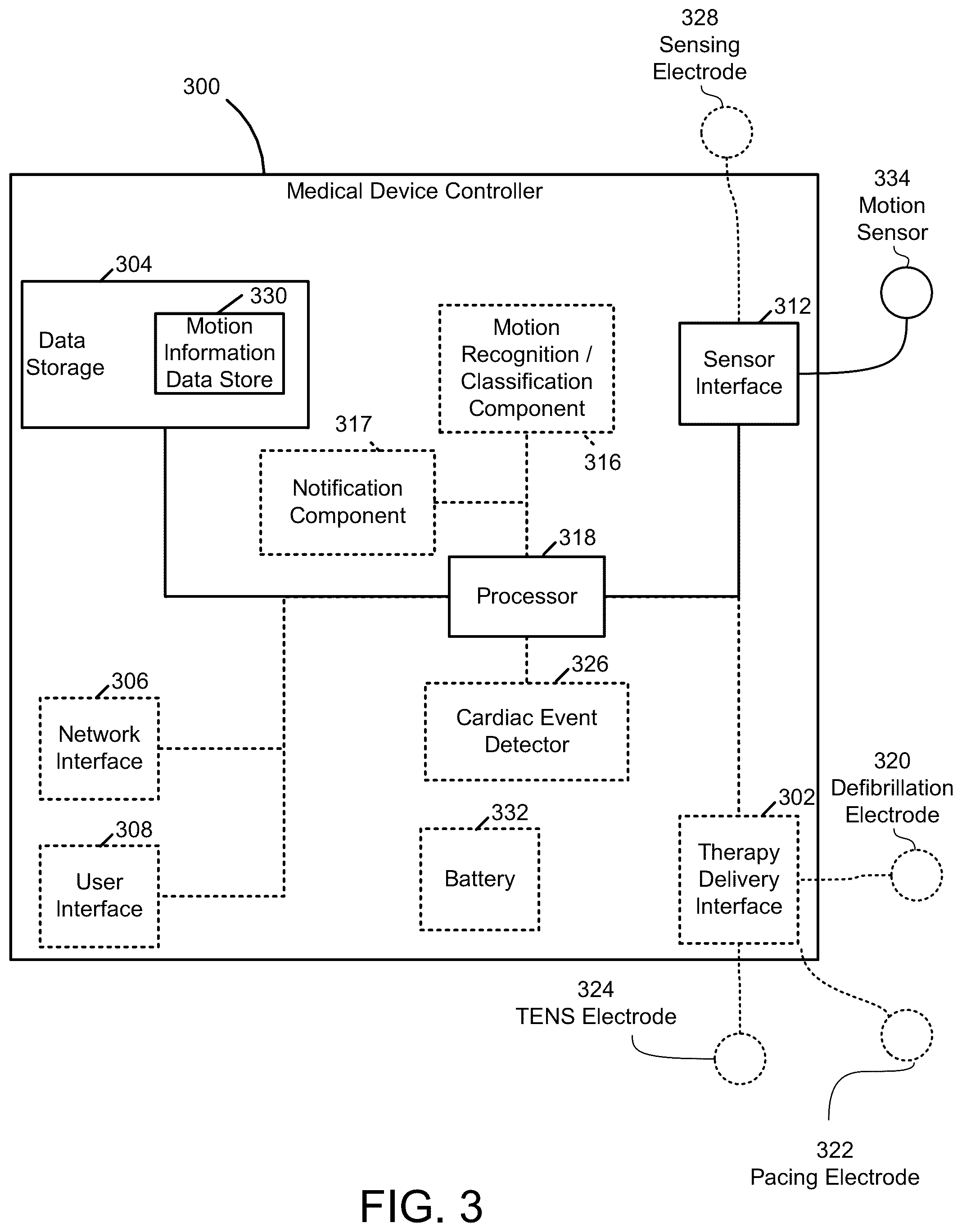 Patent US12303253 Figure 3 – Systems and methods of tracking patient movement
