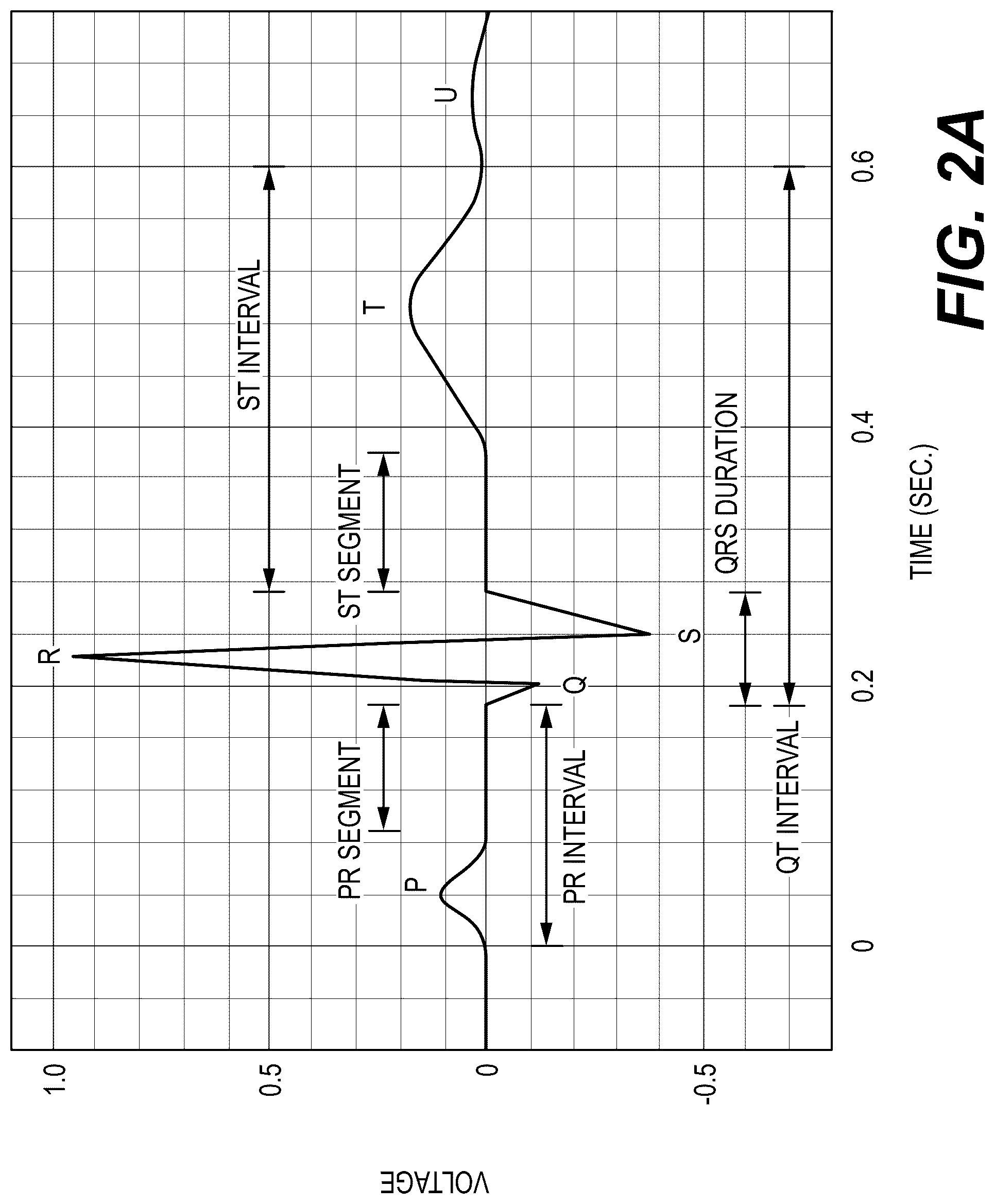 Patent US12303254 Figure 3 – Body appendage position prediction using electrocardiogram data