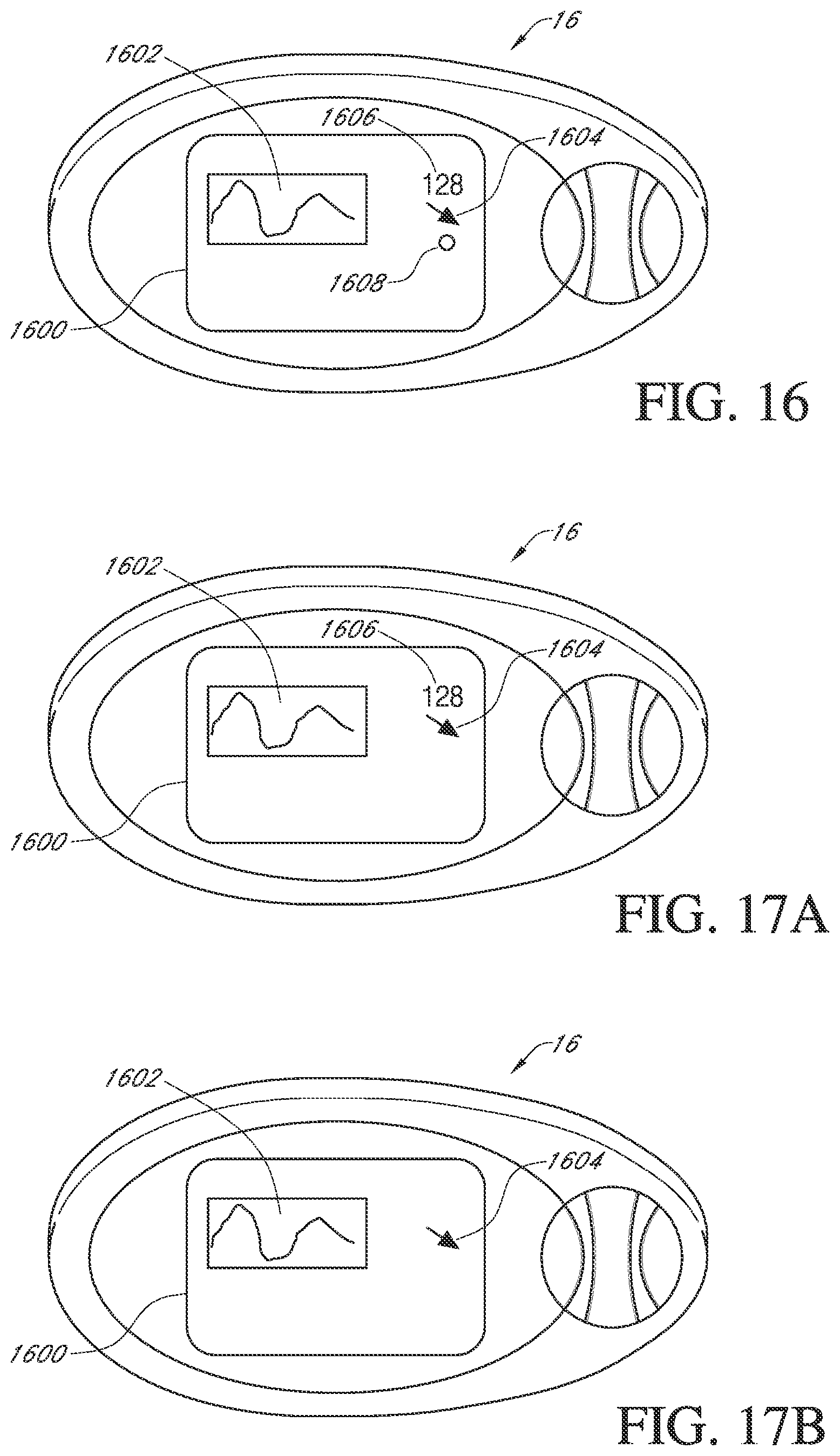 Patent US12303262 Figure 19 – Advanced continuous analyte monitoring system
