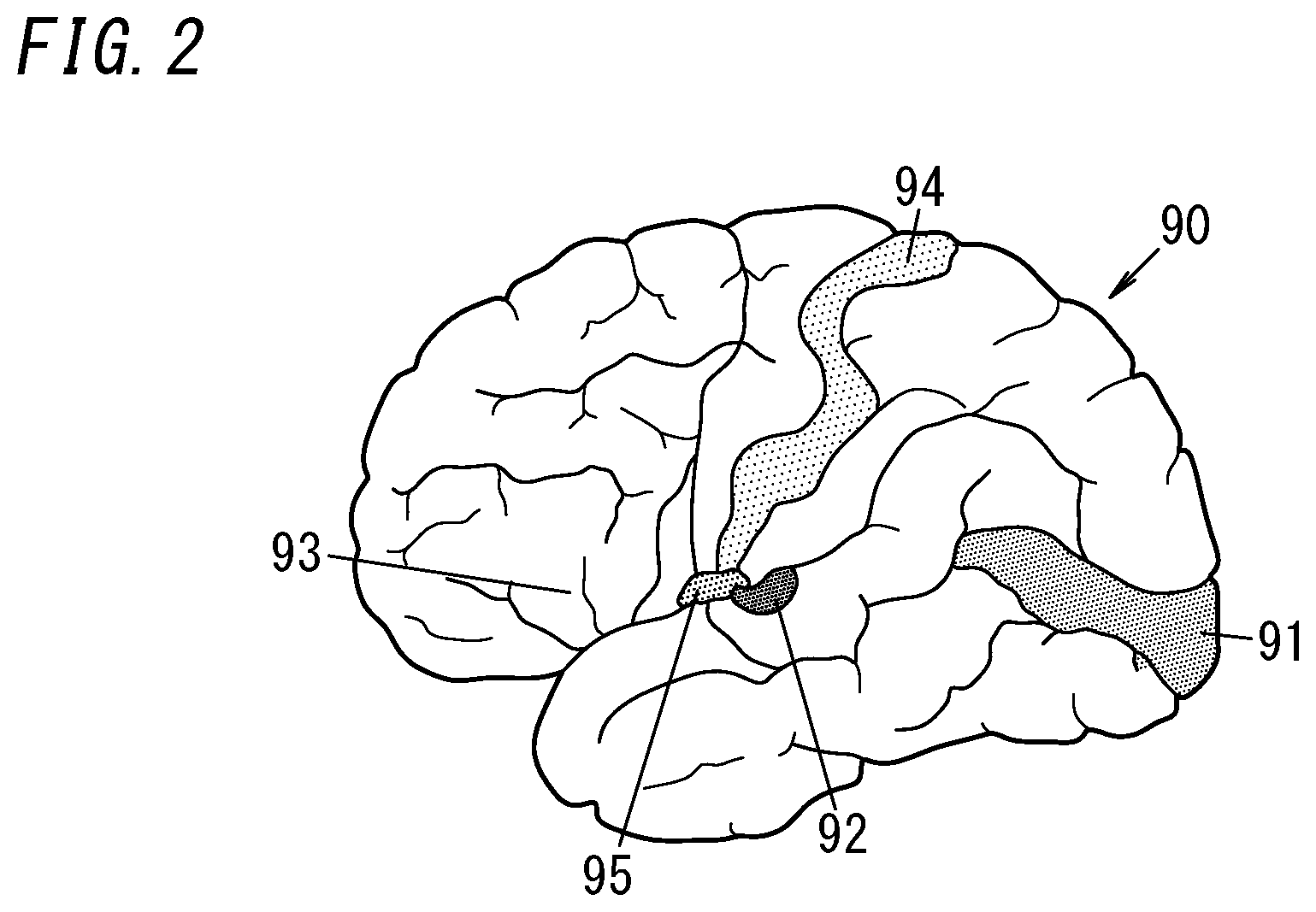 Patent US12303267 Figure 2 – Psychological condition estimation system, psychological condition estimation method, program, and method for generating estimation model