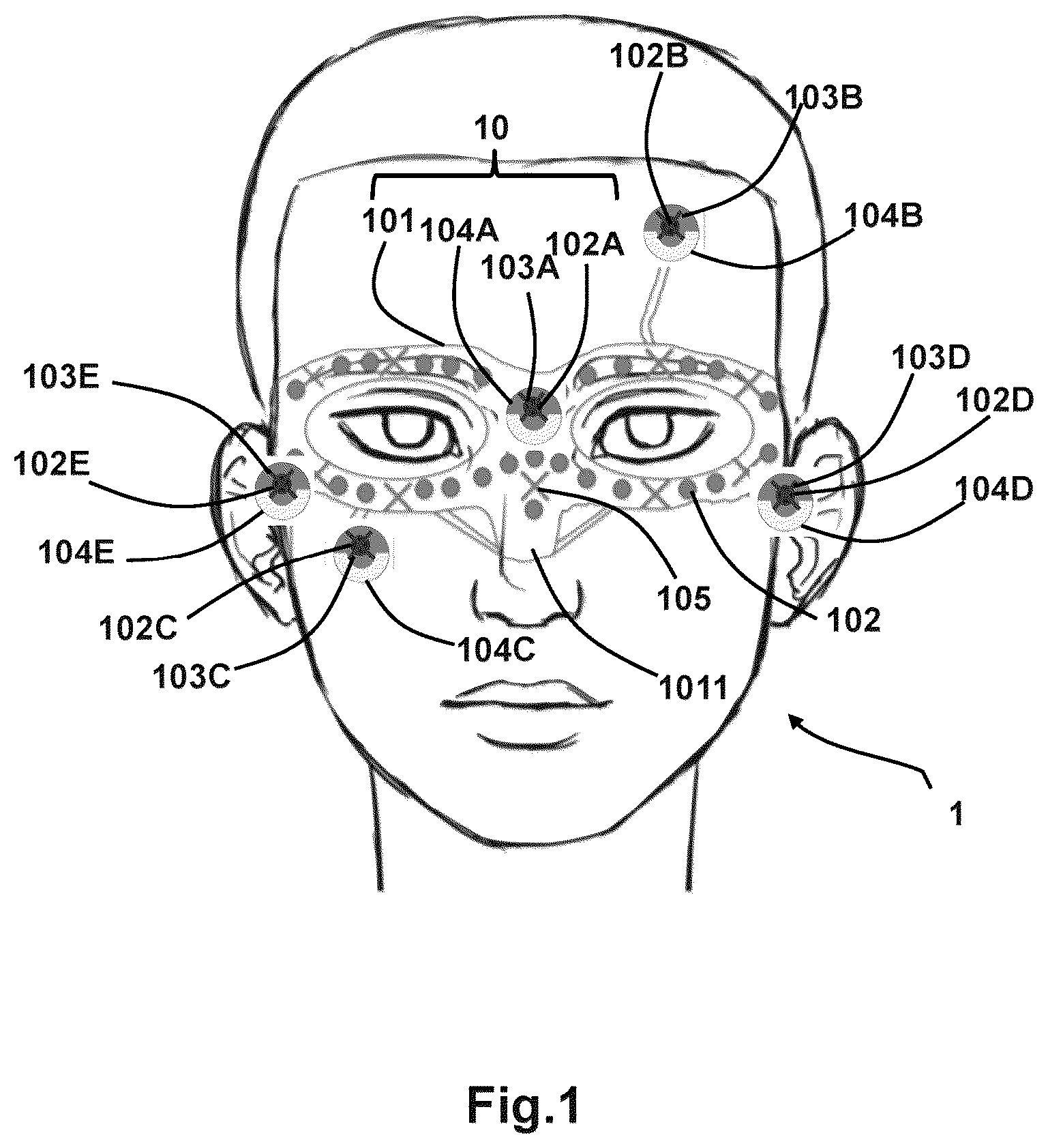 Patent US12303272 Figure 1 – Multi-modal 3D marker for co-registration of biomagnetic and magnetic resonance imaging