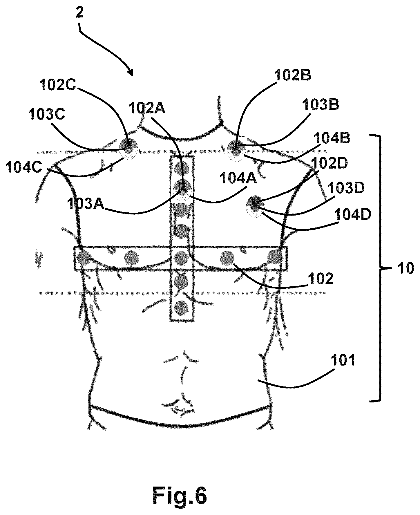 Patent US12303272 Figure 6 – Multi-modal 3D marker for co-registration of biomagnetic and magnetic resonance imaging