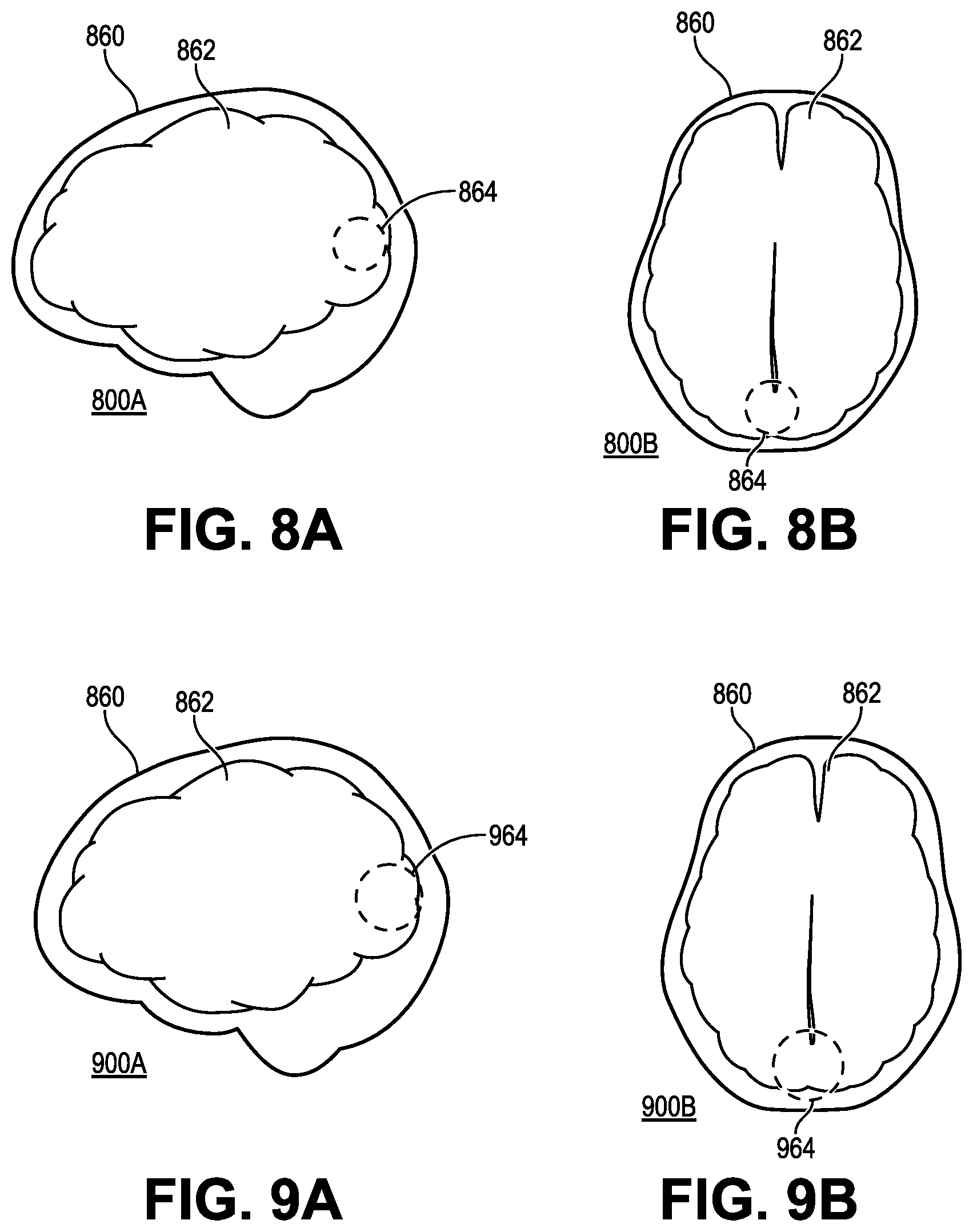 Patent US12303274 Figure 10 – Coil positioning system for noninvasive brain sensor