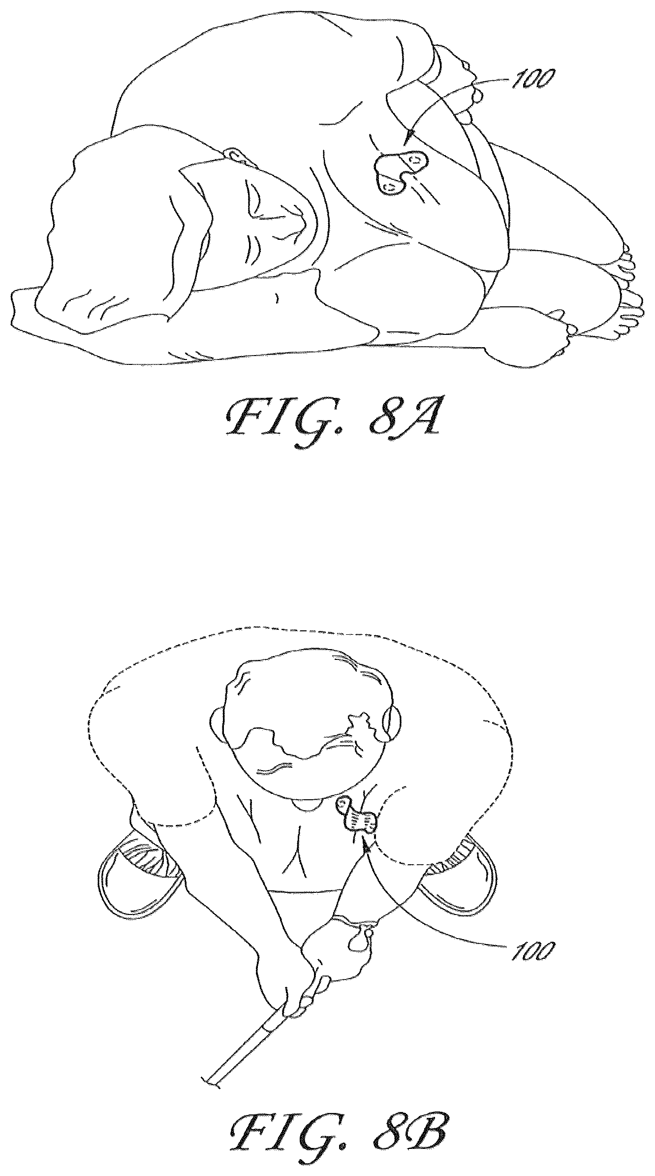 Patent US12303275 Figure 16 – Physiological monitoring device