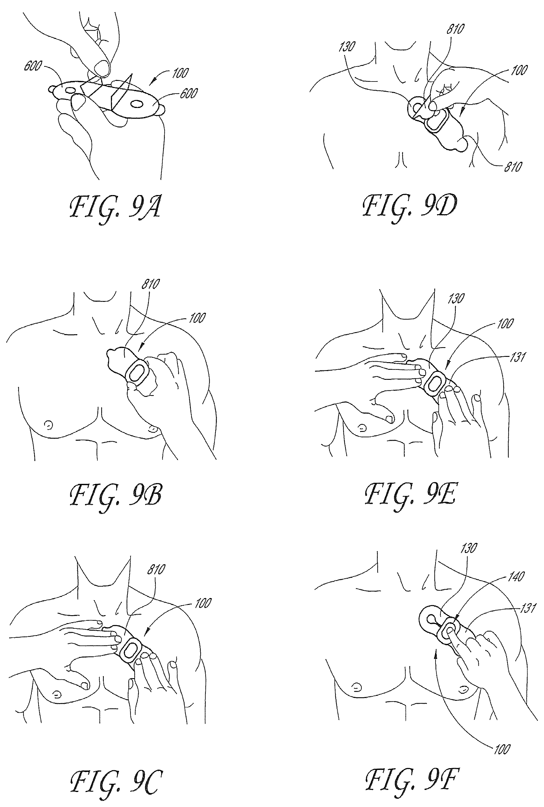 Patent US12303275 Figure 17 – Physiological monitoring device