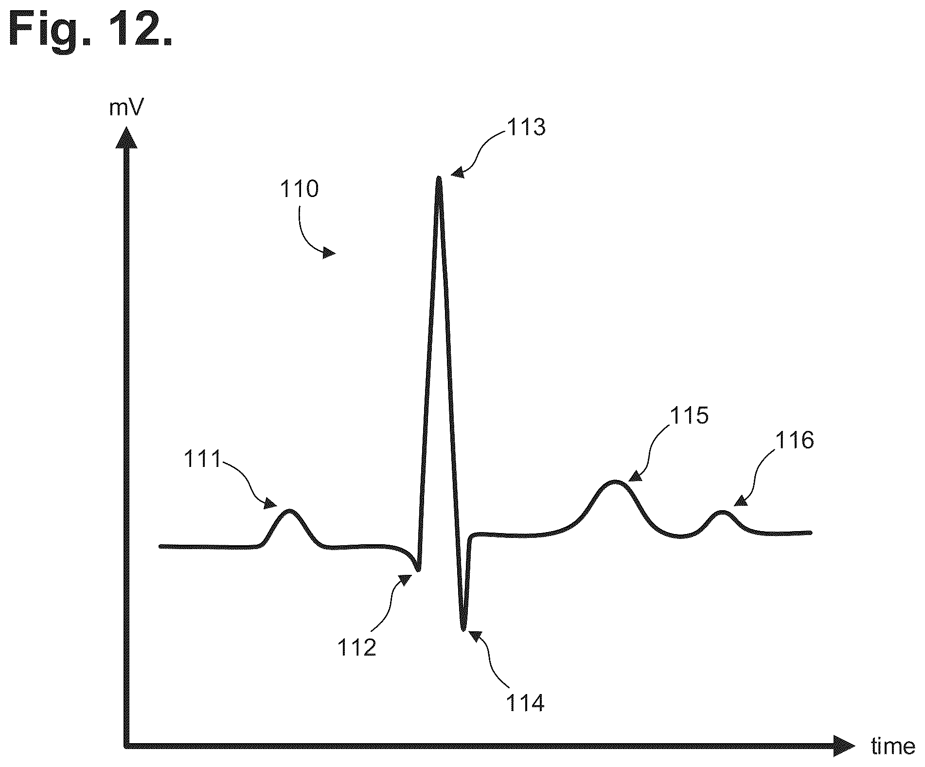 Patent US12303278 Figure 7 – Electrocardiography patch