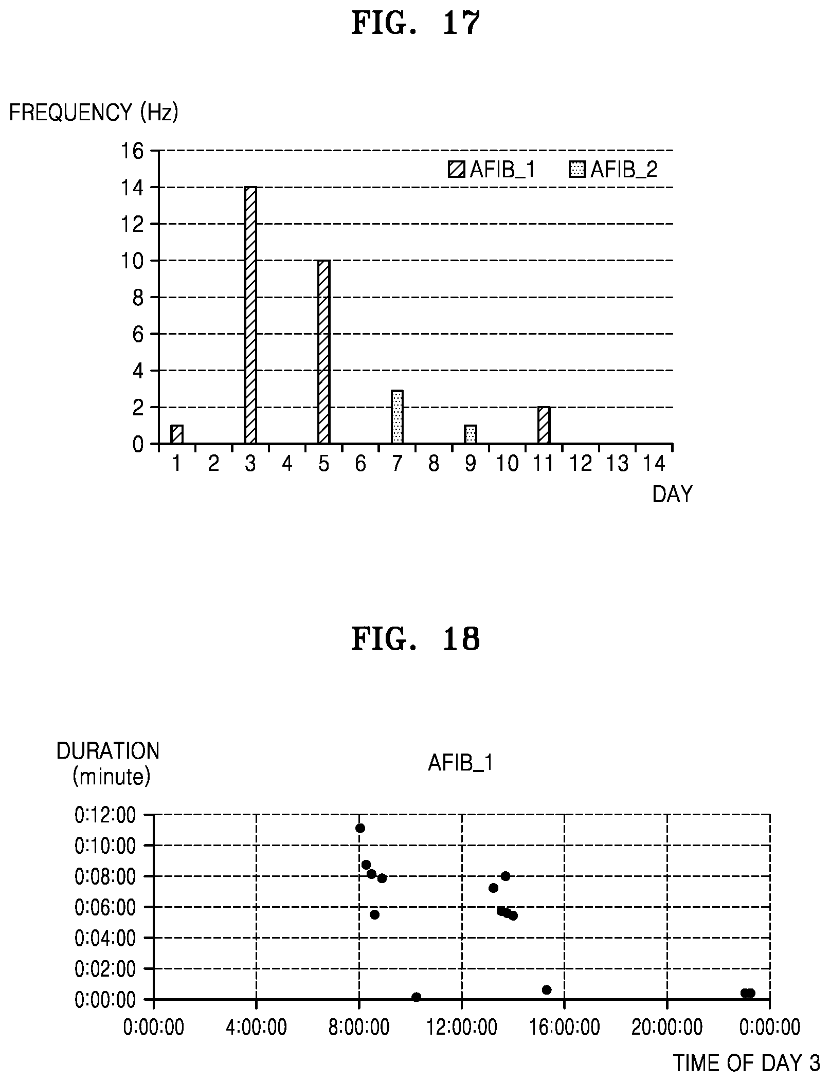 Patent US12303279 Figure 17 – Electrocardiogram data processing server, method and computer program for displaying analysis data of electrocardiogram signal