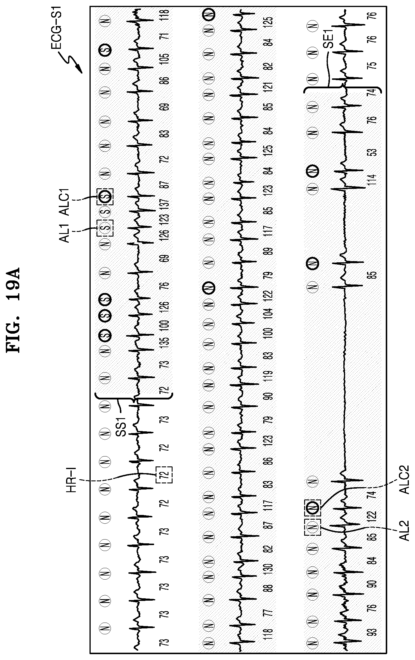 Patent US12303279 Figure 18 – Electrocardiogram data processing server, method and computer program for displaying analysis data of electrocardiogram signal