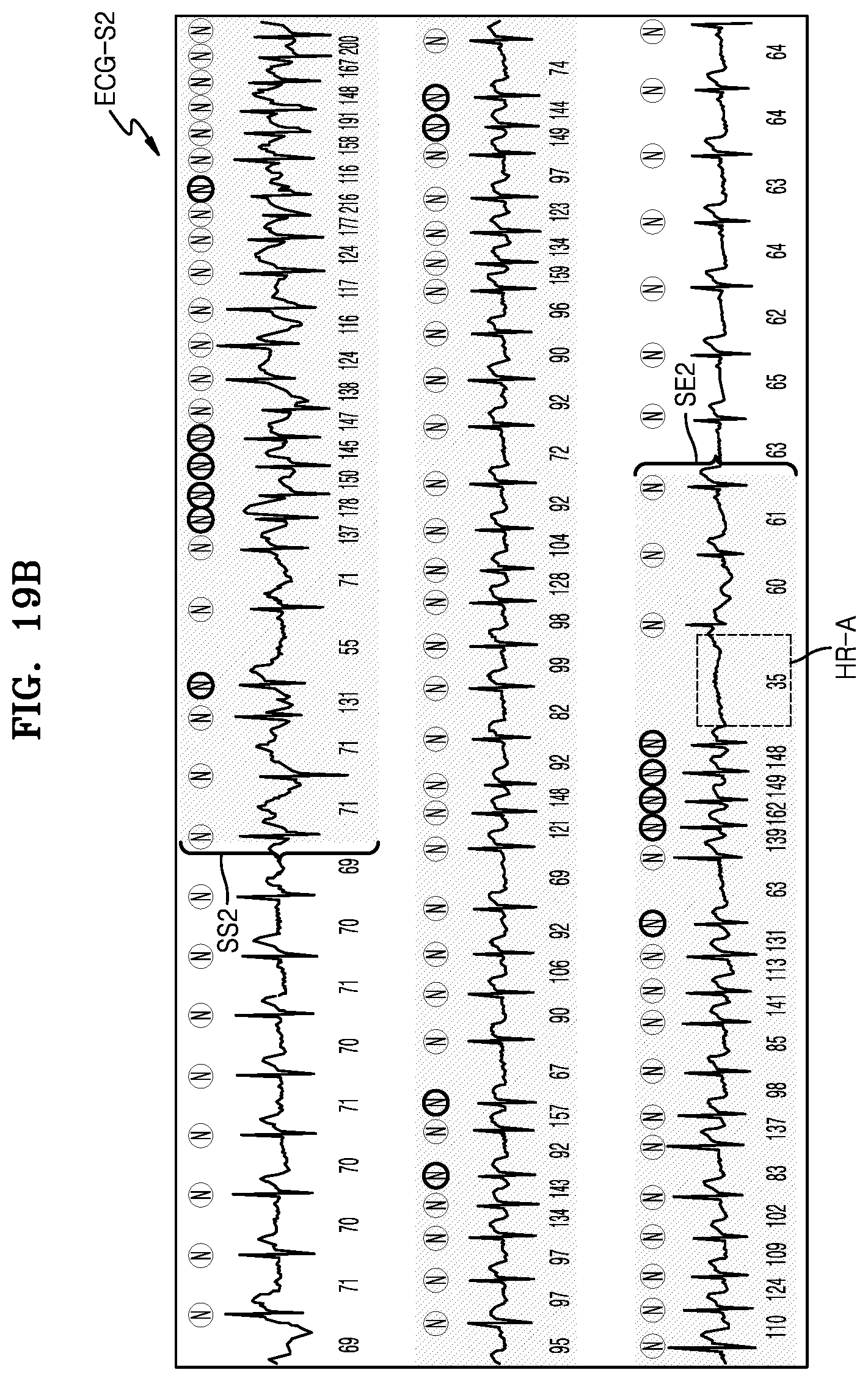 Patent US12303279 Figure 19 – Electrocardiogram data processing server, method and computer program for displaying analysis data of electrocardiogram signal