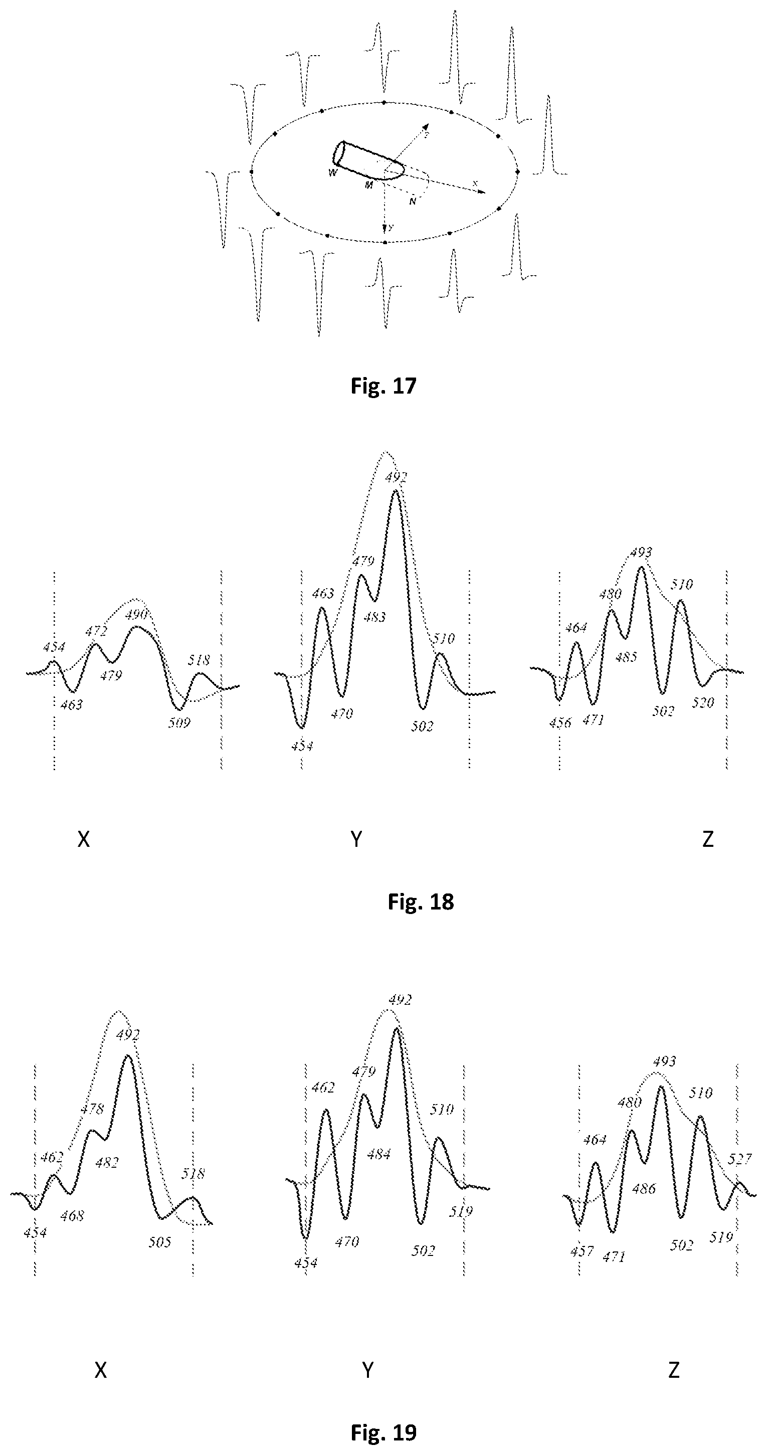 Patent US12303280 Figure 8 – Method for determining electrical activity of cardiac muscle
