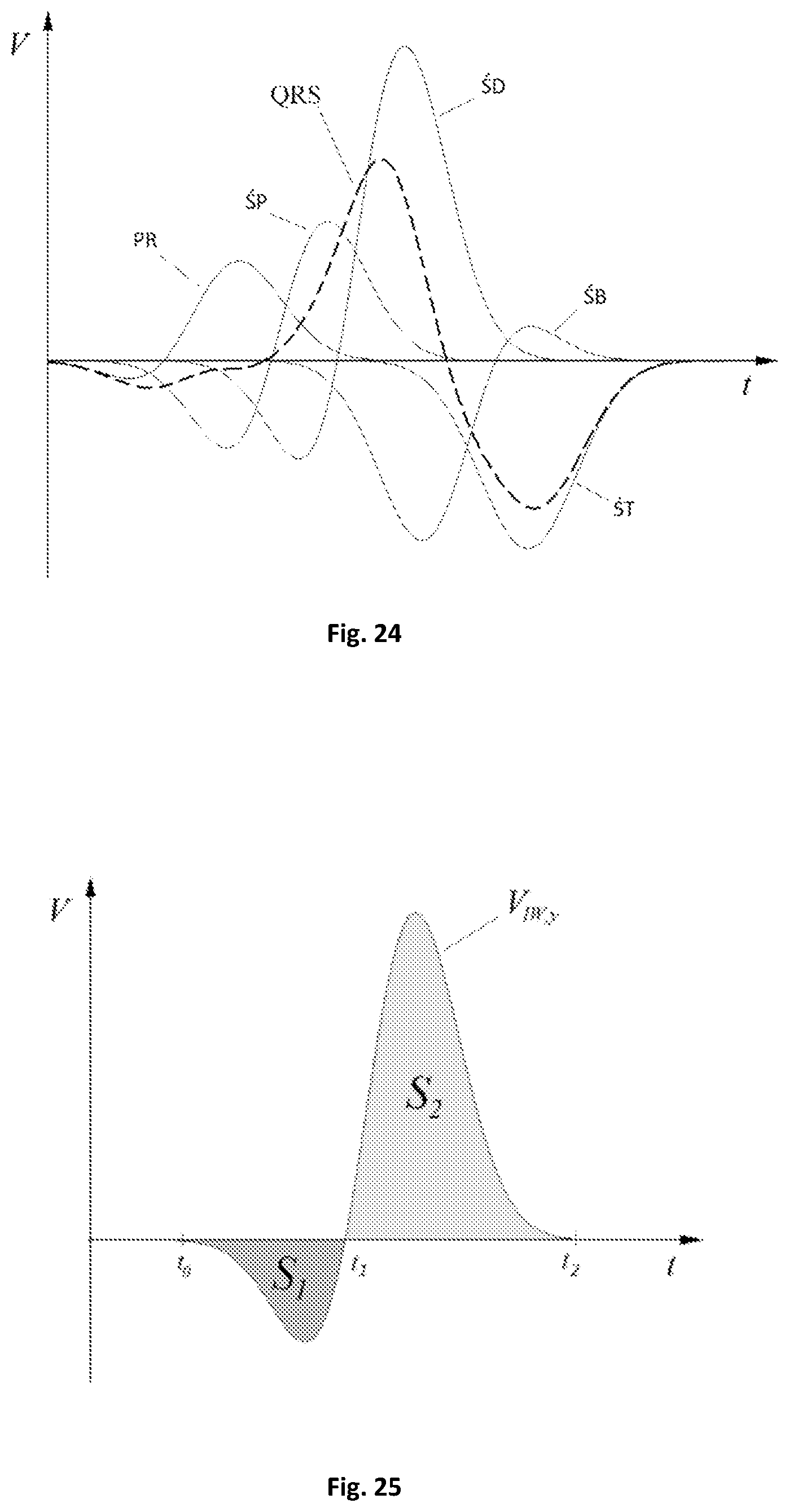 Patent US12303280 Figure 11 – Method for determining electrical activity of cardiac muscle
