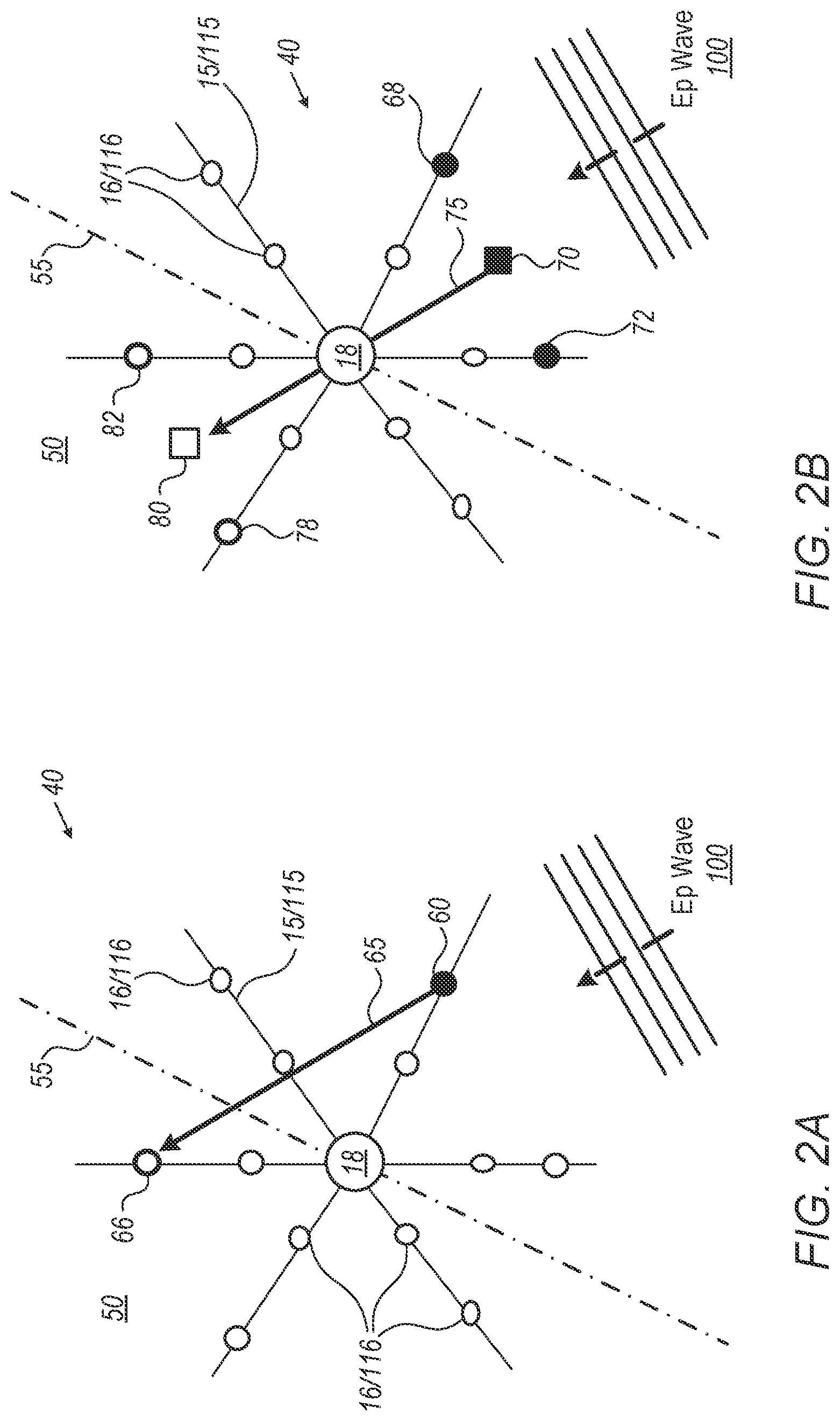 Patent US12303281 Figure 2 – Mapping resolution of electrophysiological (EP) wave propagating on the surface of patient heart