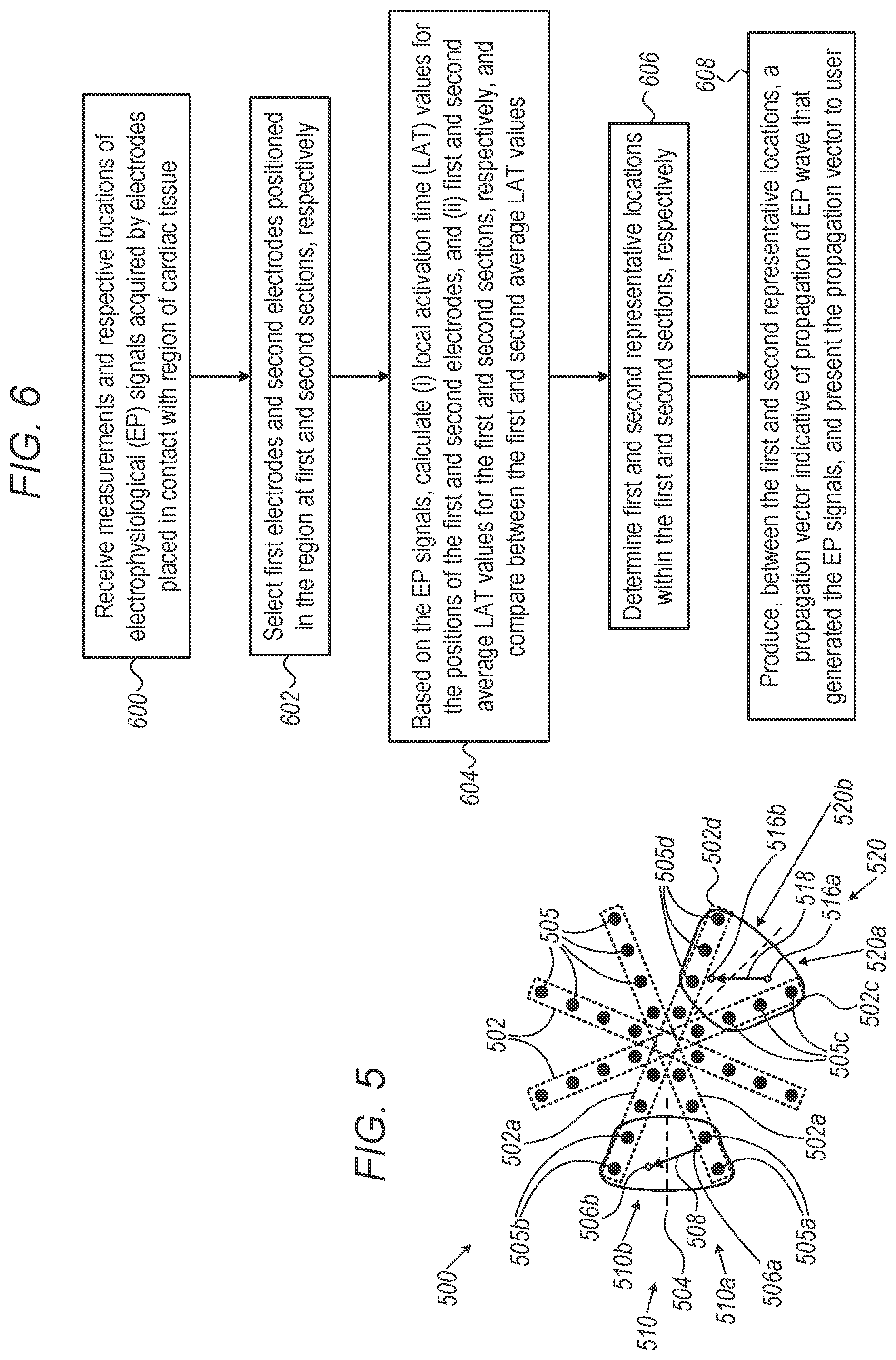 Patent US12303281 Figure 5 – Mapping resolution of electrophysiological (EP) wave propagating on the surface of patient heart