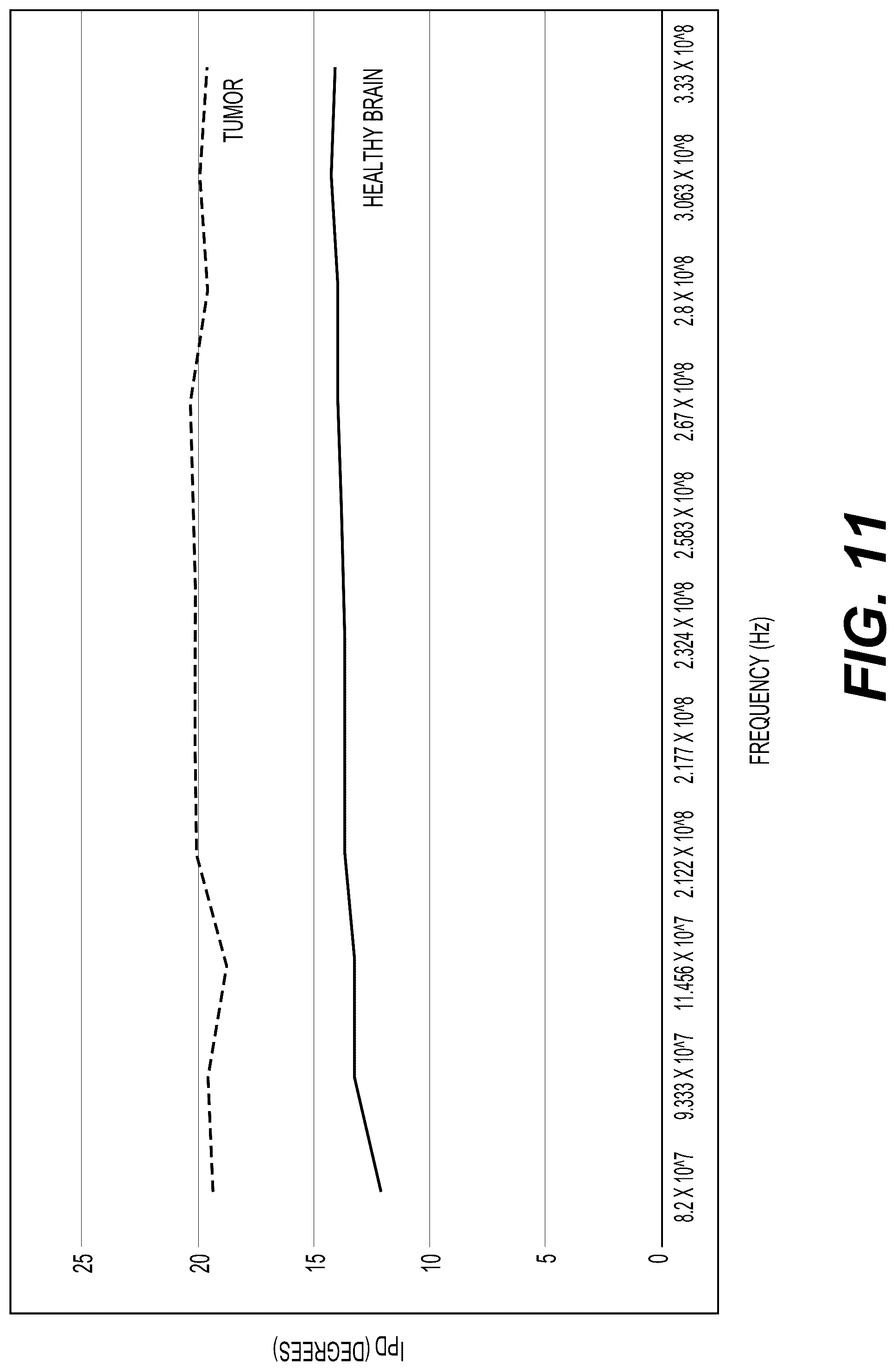Patent US12303284 Figure 11 – System and method for detecting brain abnormalities using backscattered radiation