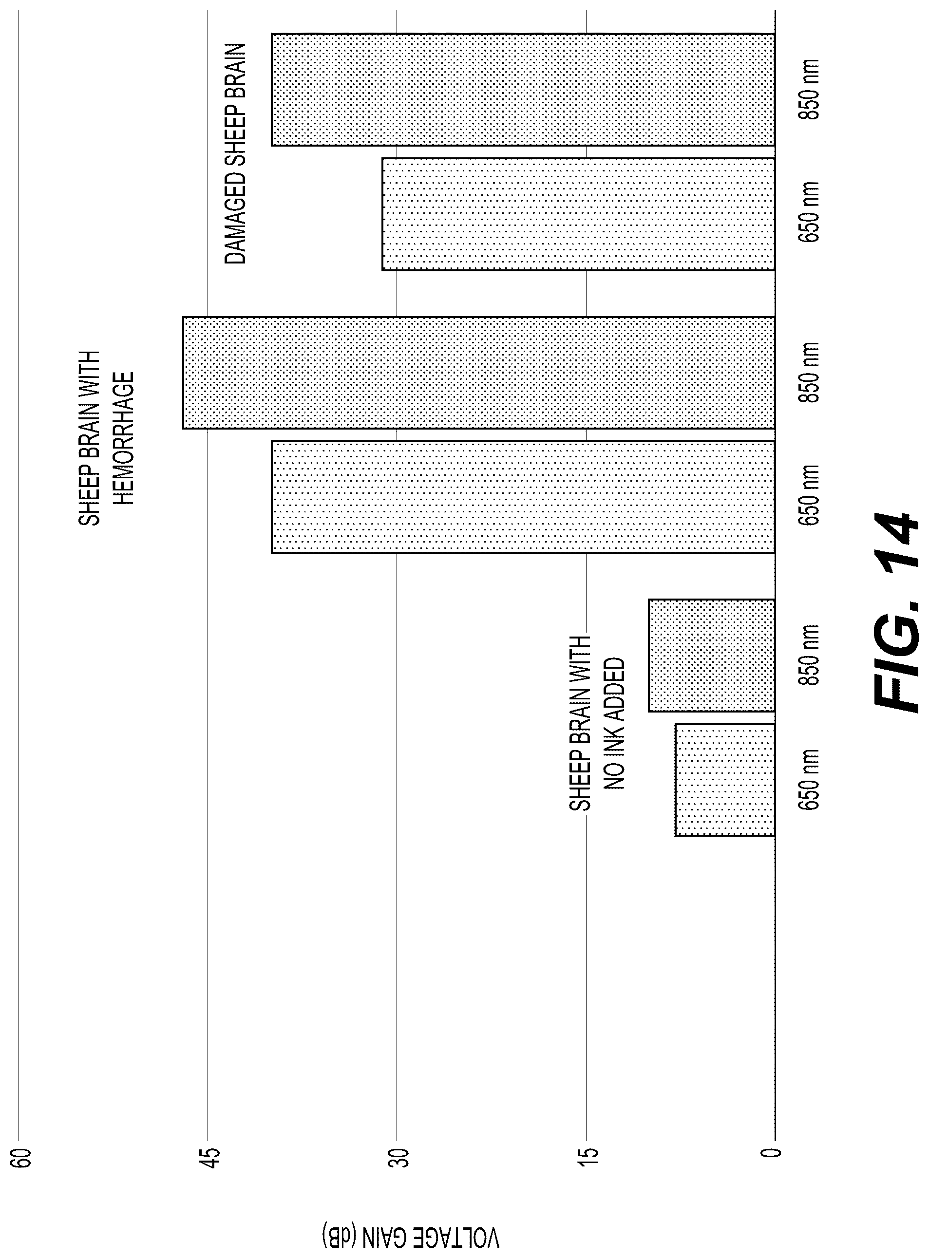 Patent US12303284 Figure 14 – System and method for detecting brain abnormalities using backscattered radiation