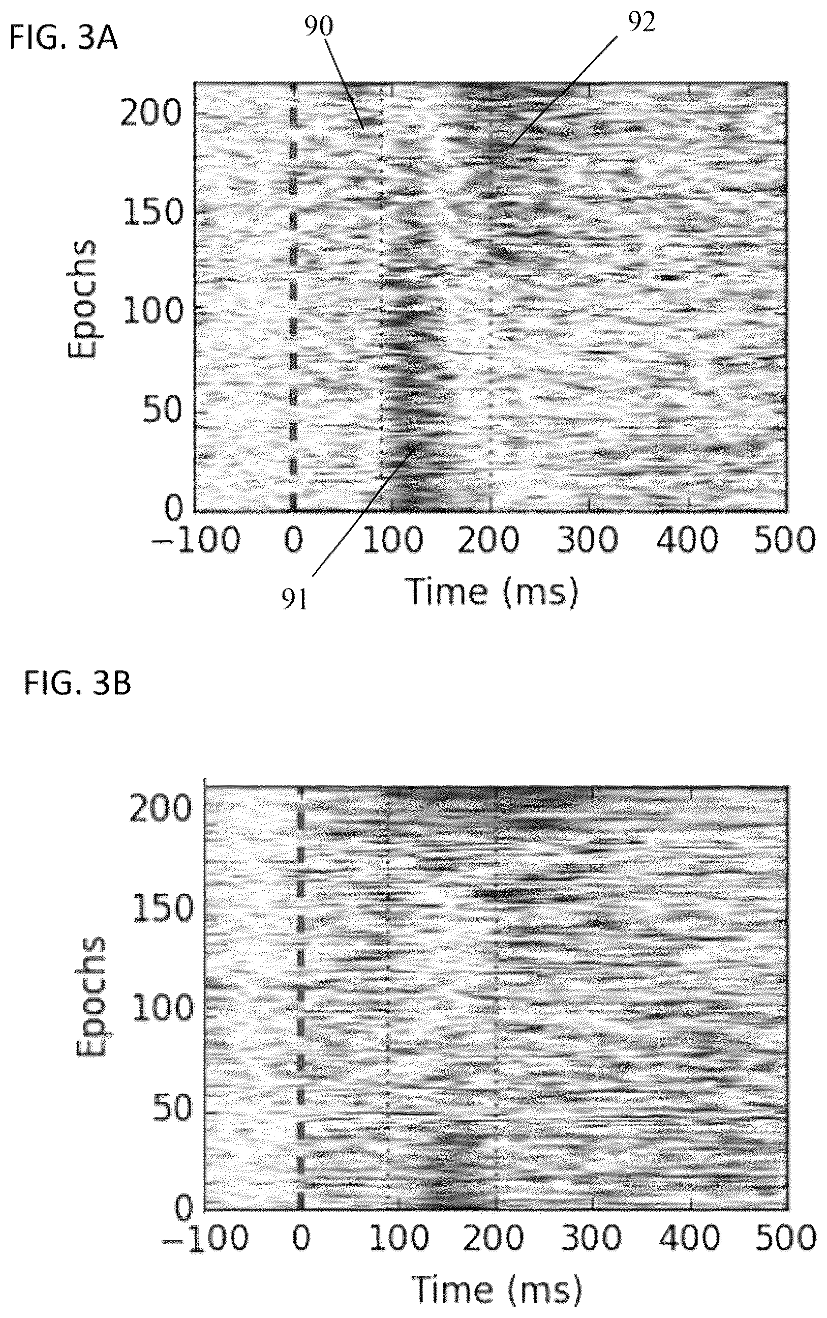 Patent US12303285 Figure 7 – Methods and magnetic imaging devices to inventory human brain cortical function