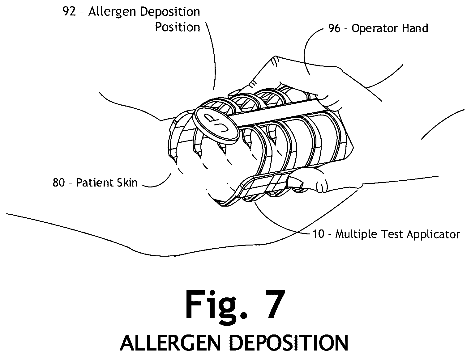Patent US12303286 Figure 10 – Automated allergy office system and method