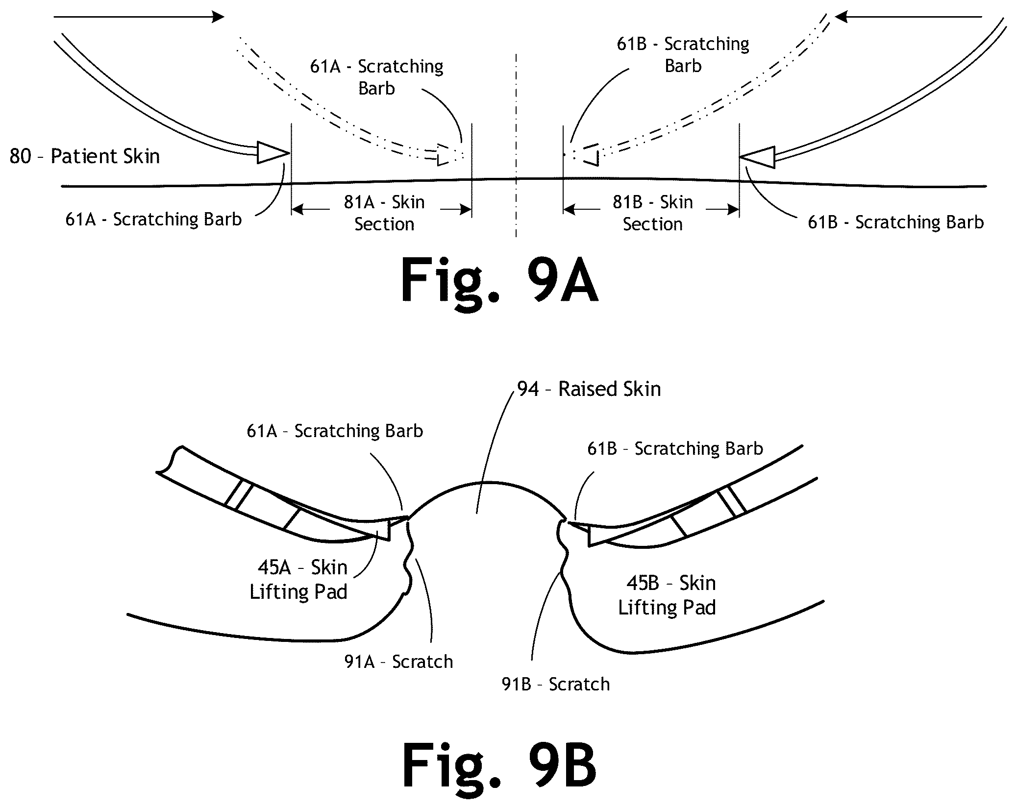 Patent US12303286 Figure 12 – Automated allergy office system and method