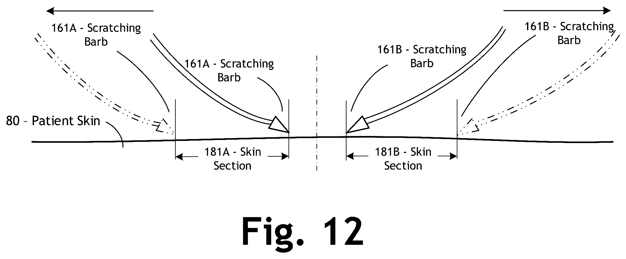 Patent US12303286 Figure 15 – Automated allergy office system and method