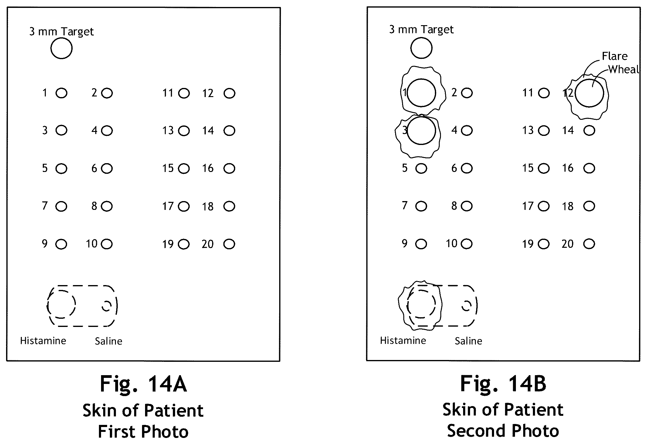 Patent US12303286 Figure 17 – Automated allergy office system and method