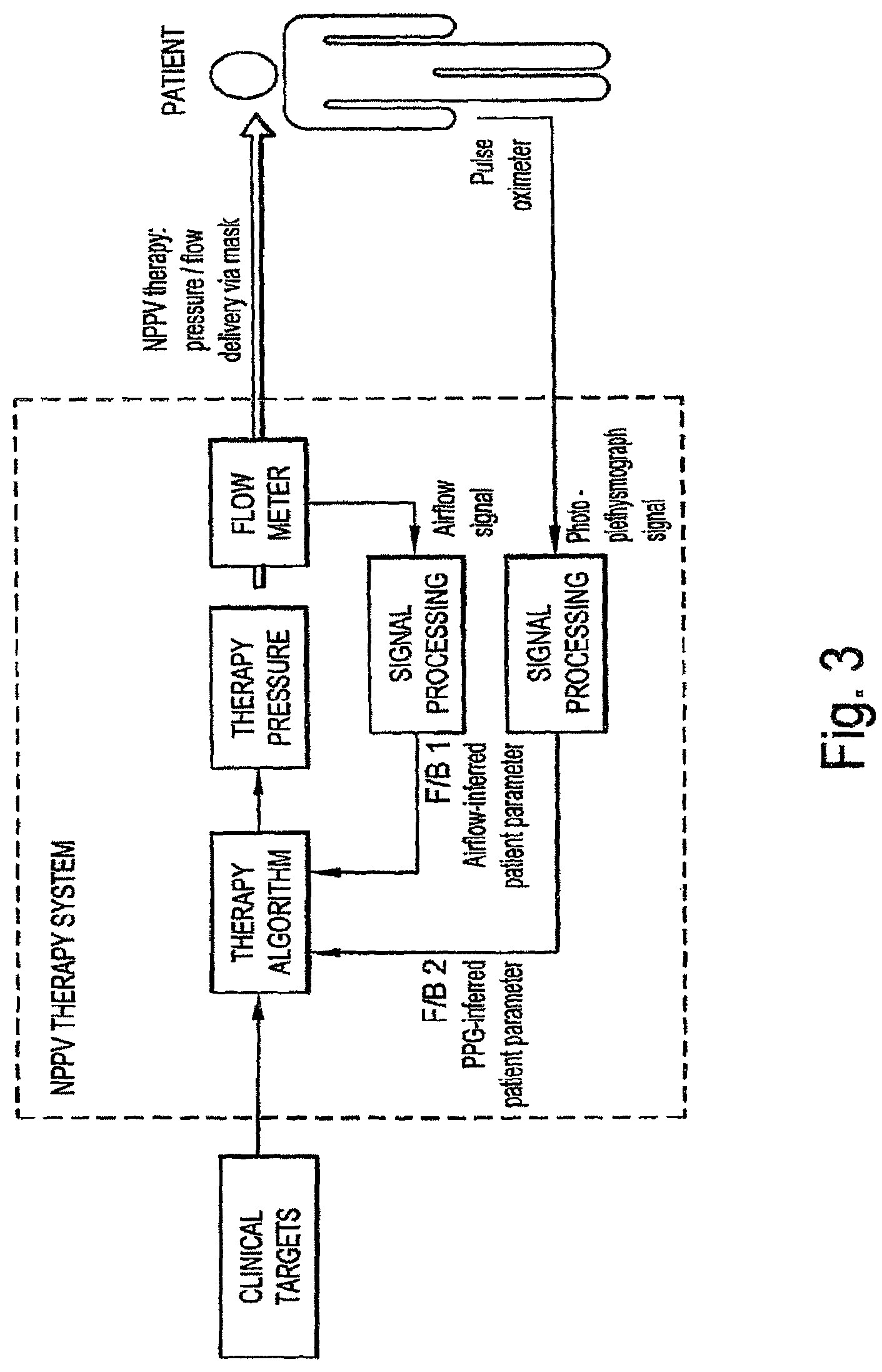 Patent US12303288 Figure 3 – Systems, methods, and/or apparatuses for non-invasive monitoring of respiratory parameters in sleep disordered breathing