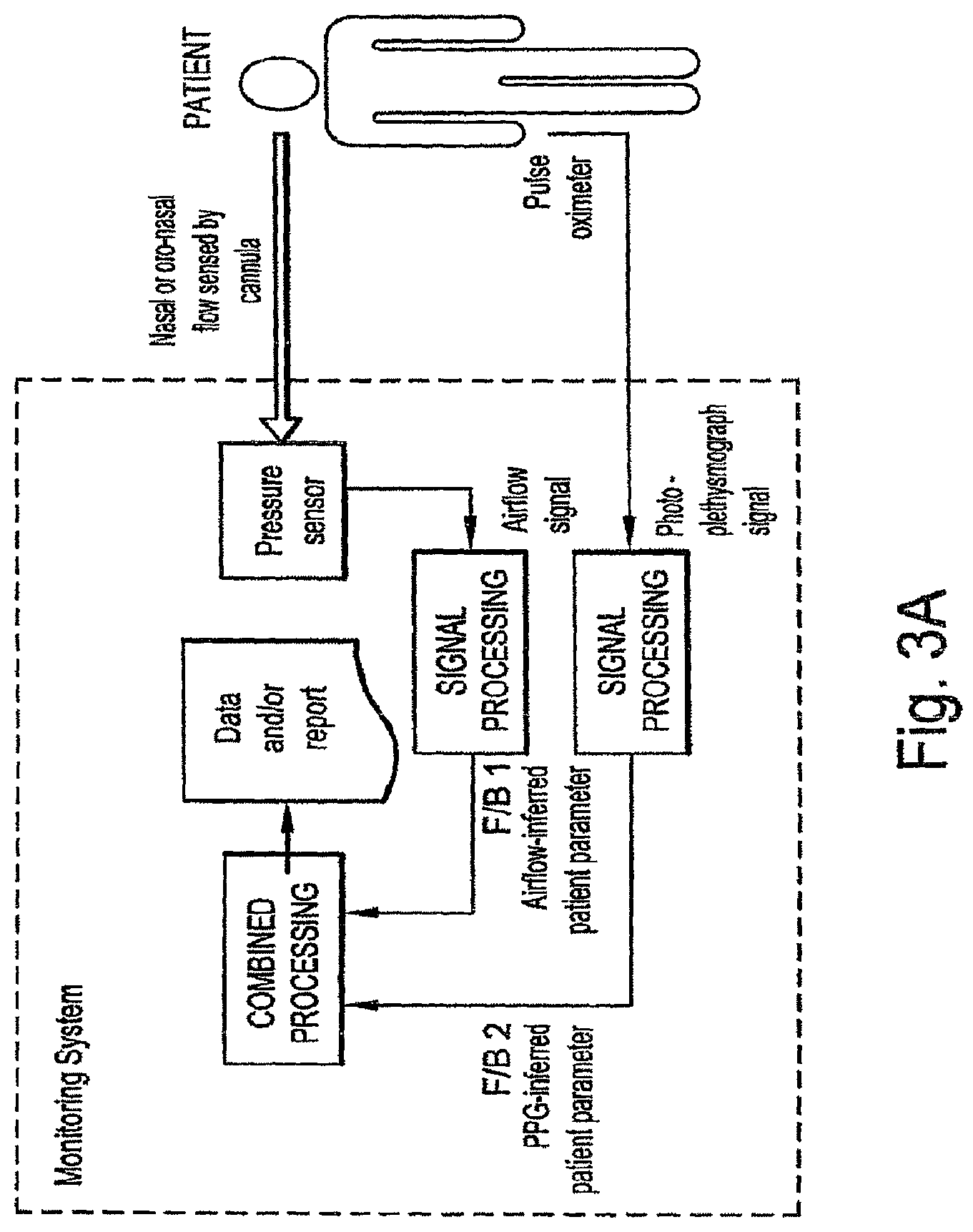 Patent US12303288 Figure 4 – Systems, methods, and/or apparatuses for non-invasive monitoring of respiratory parameters in sleep disordered breathing